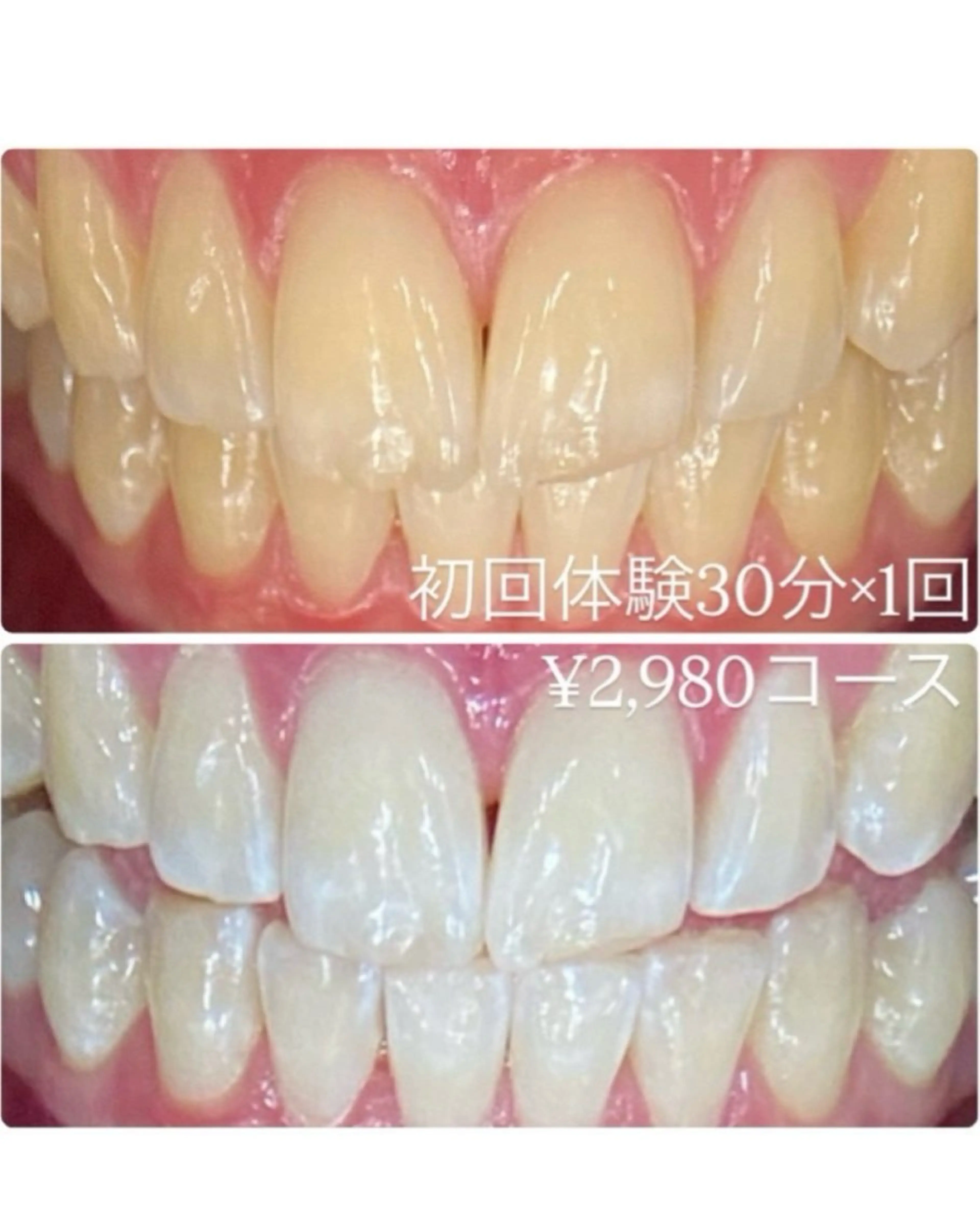 メンズ その他 ホワイトニングルーム　川崎店所属・ホワイトニング ルーム　川崎店のその他イメージ