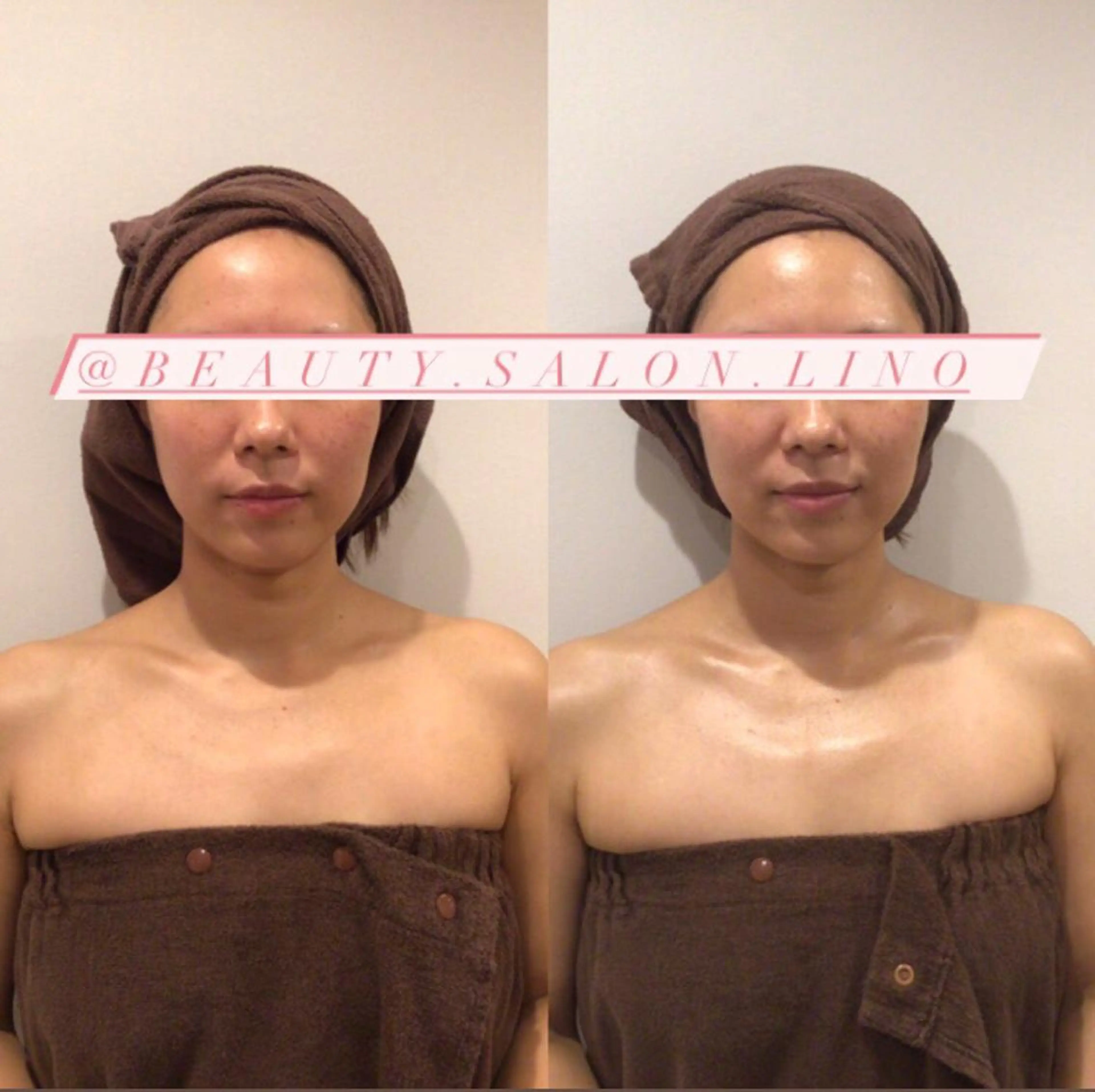 痩身×フェイシャル ブライダル|Linoのエステ・リラクイメージ