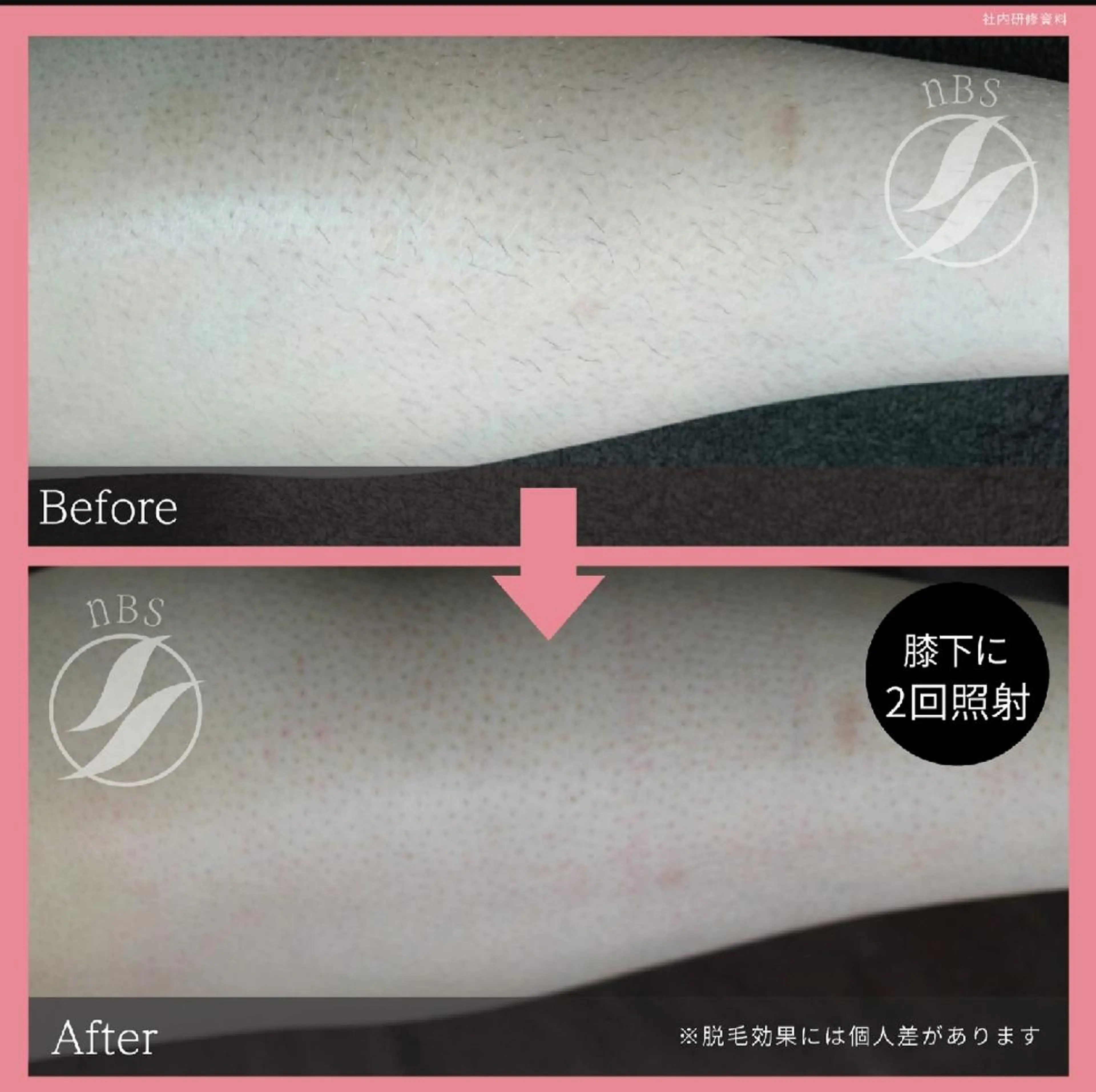 beauty salon by BMbm所属・名倉 彩乃のエステ・リラクイメージ