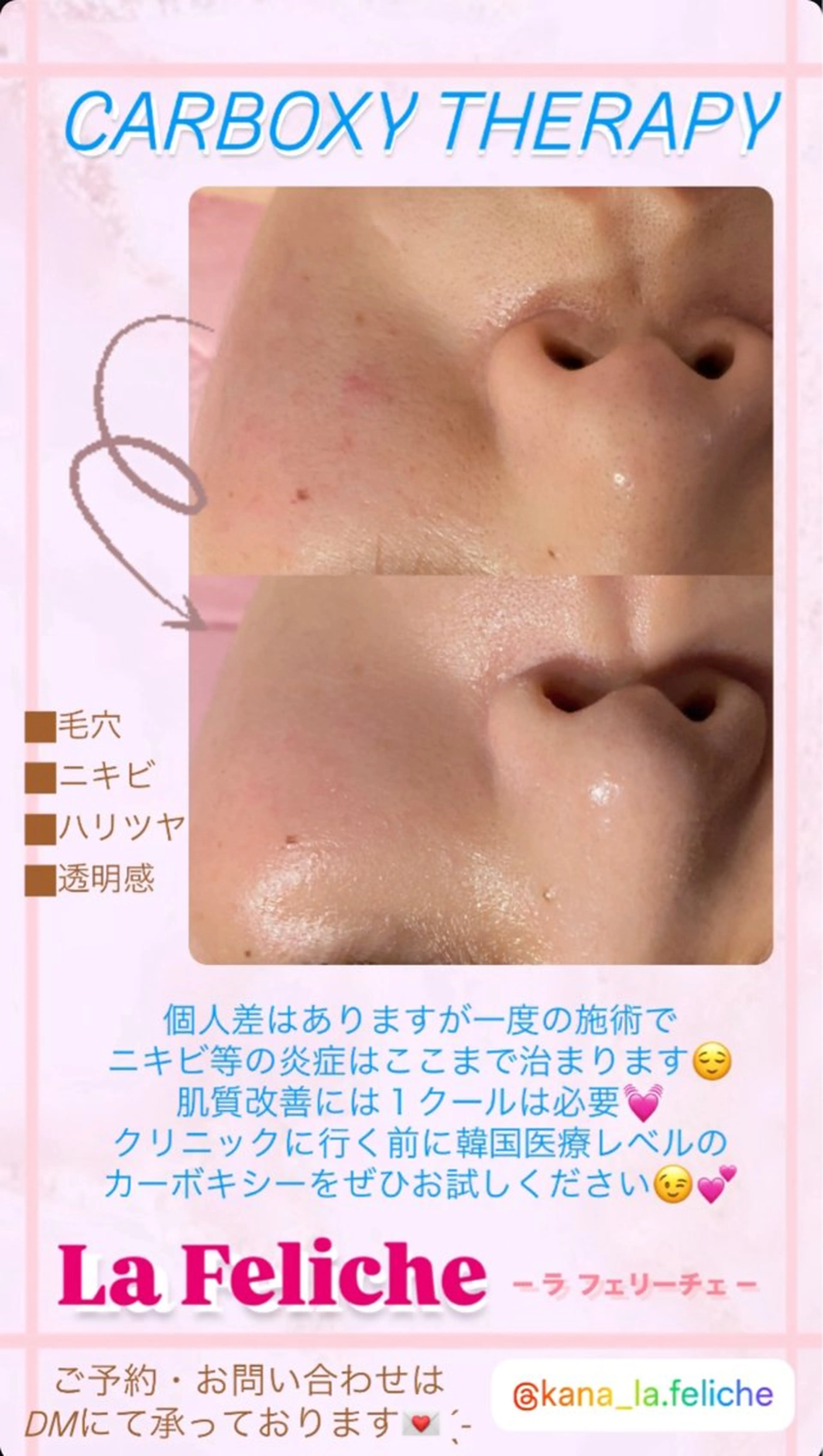 エステ La Feliche 佳奈のエステ・リラクイメージ