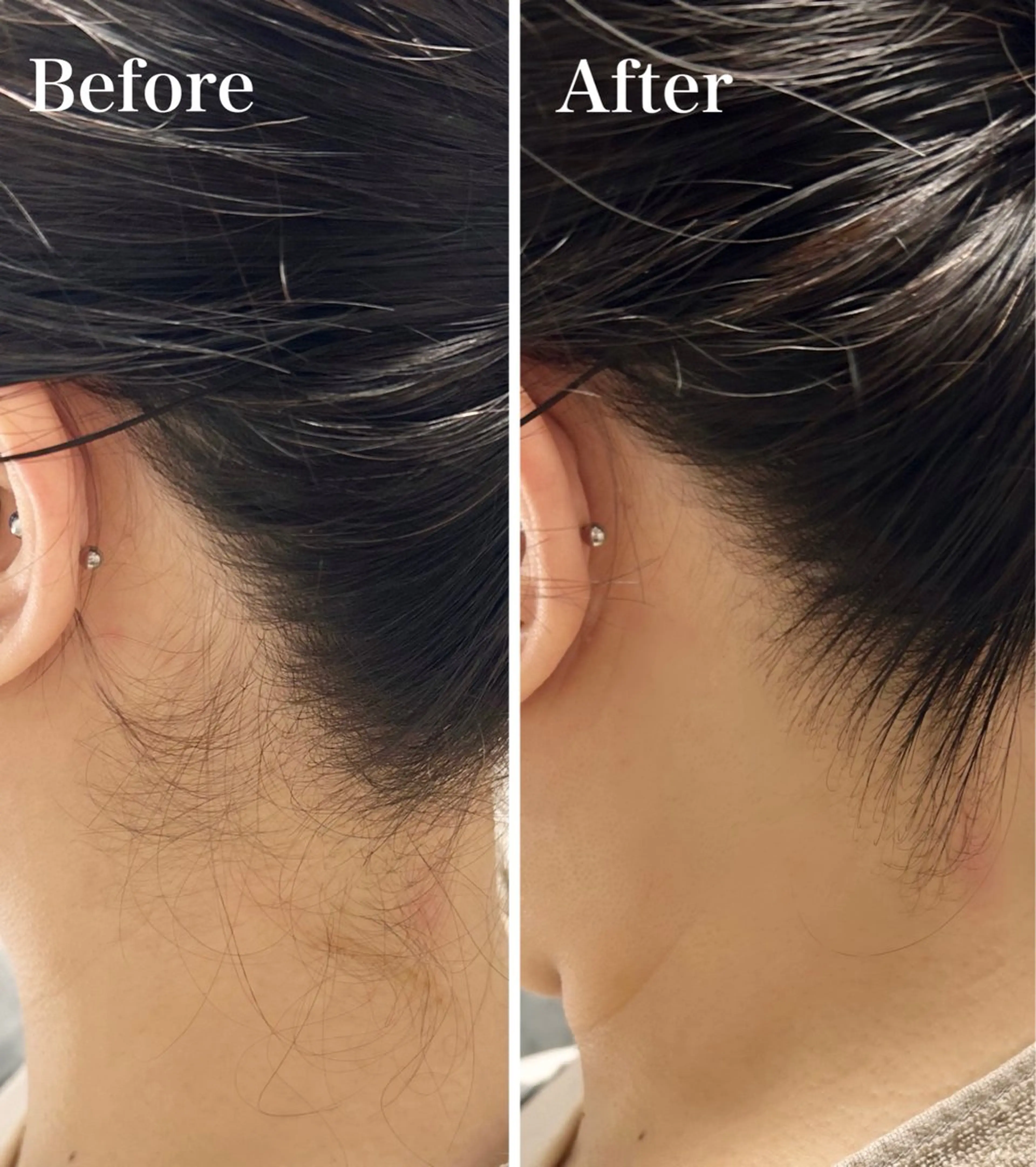 OOPARTS所属・大塚 杏美のエステ・リラクイメージ