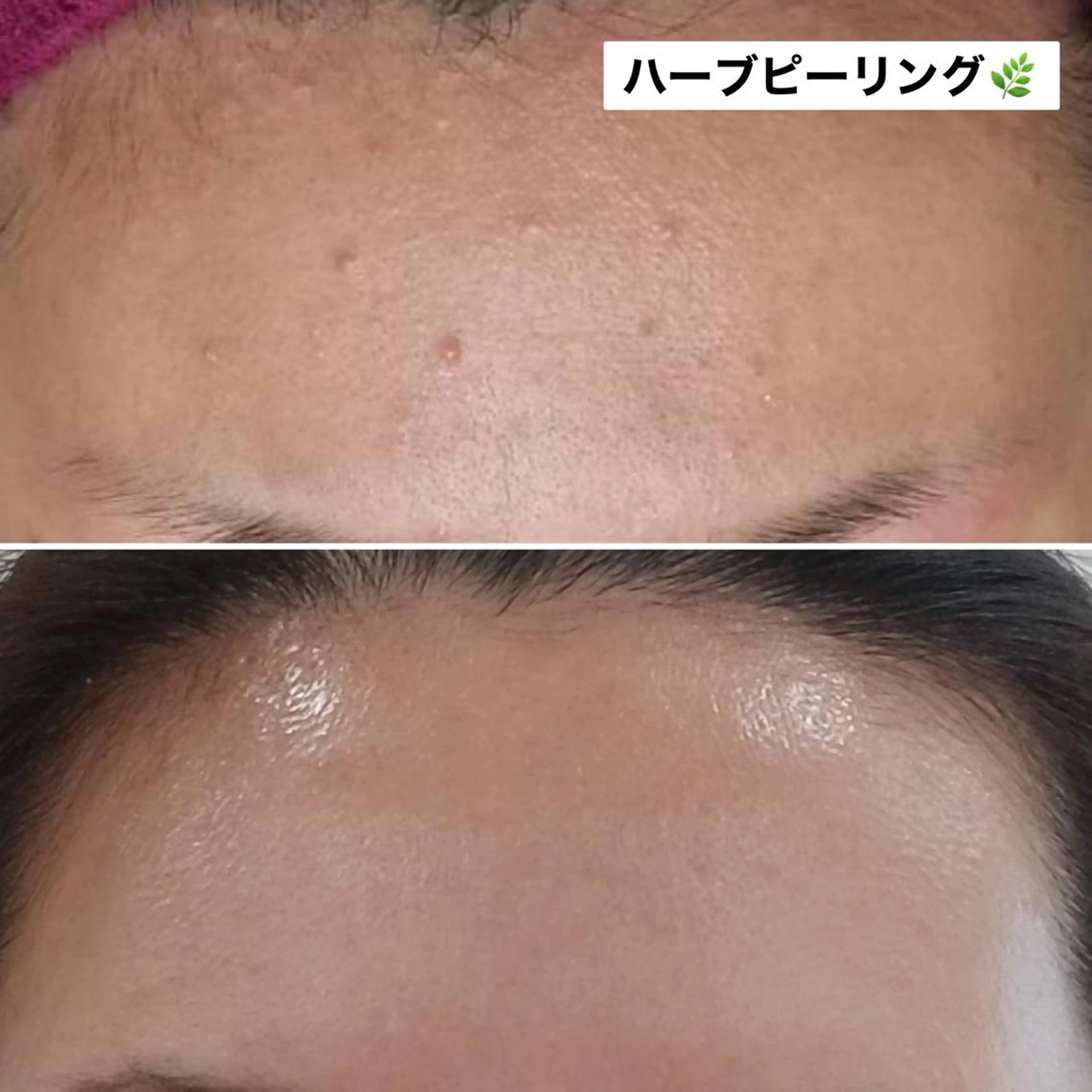 ネイル マツエク・マツパ アイブロウ エステ Anacia Beauty Salon所属・美肌脱毛&毛穴専門 Anaciaのエステ・リラクイメージ