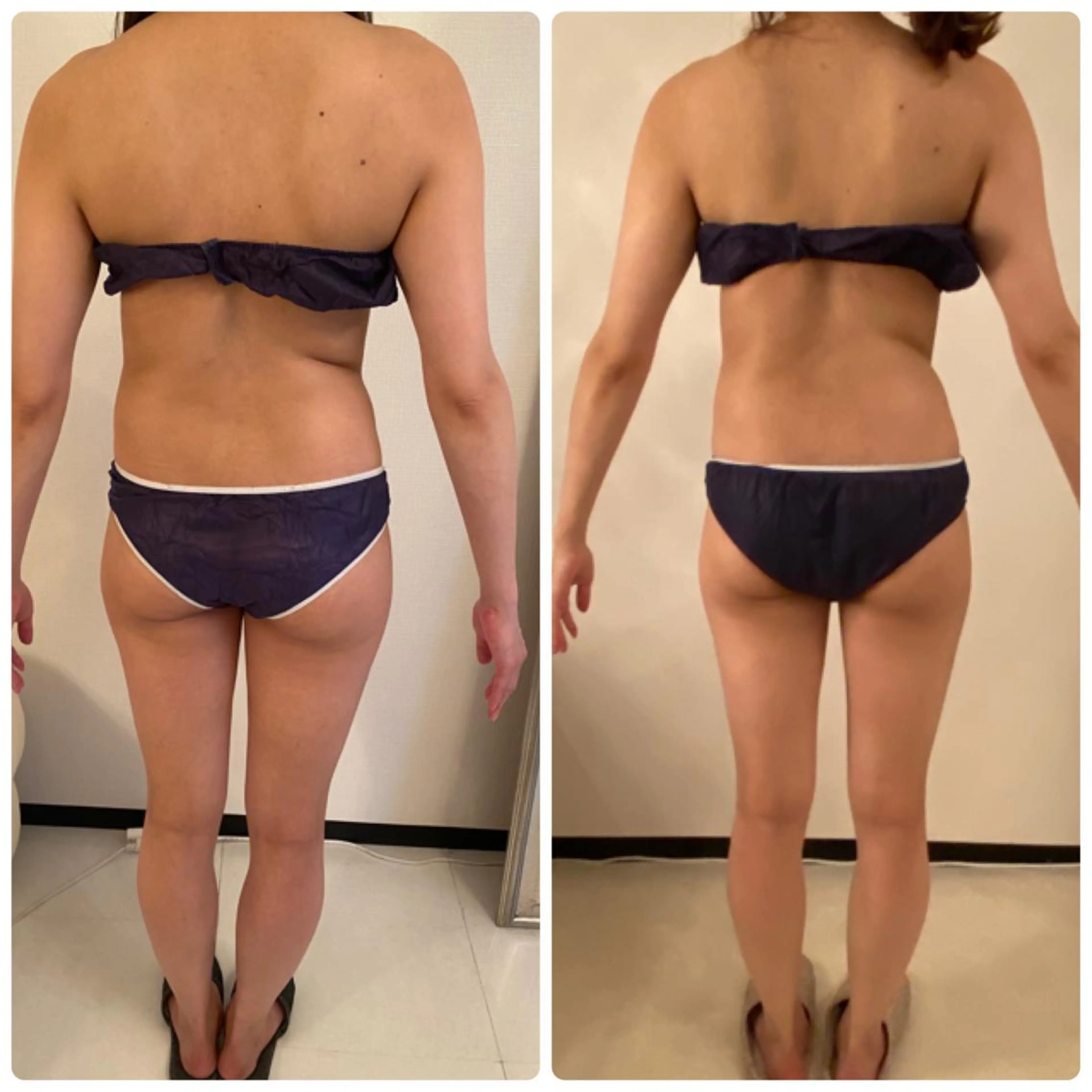 FLEUR大阪・整体 ・ハイフ・痩身・小顔のエステ・リラクイメージ