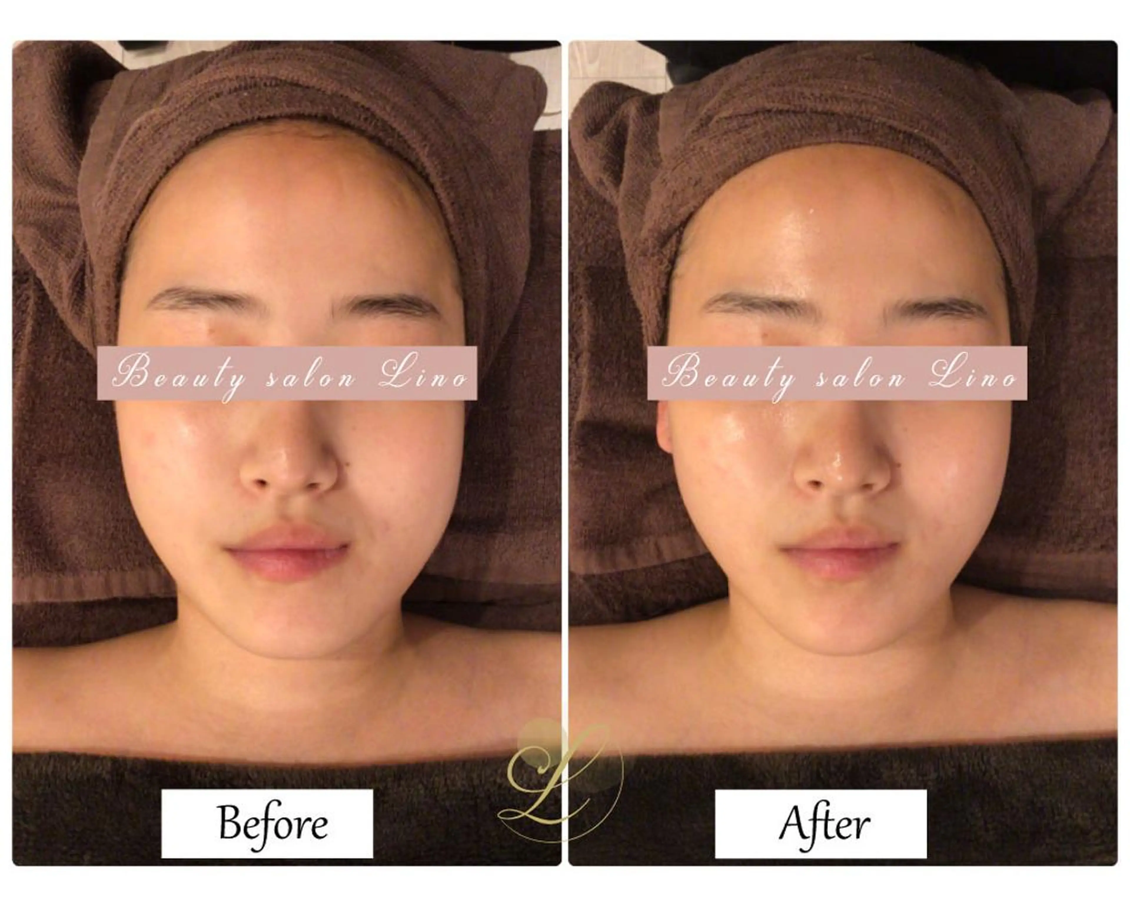 痩身×フェイシャル ブライダル|Linoのエステ・リラクイメージ