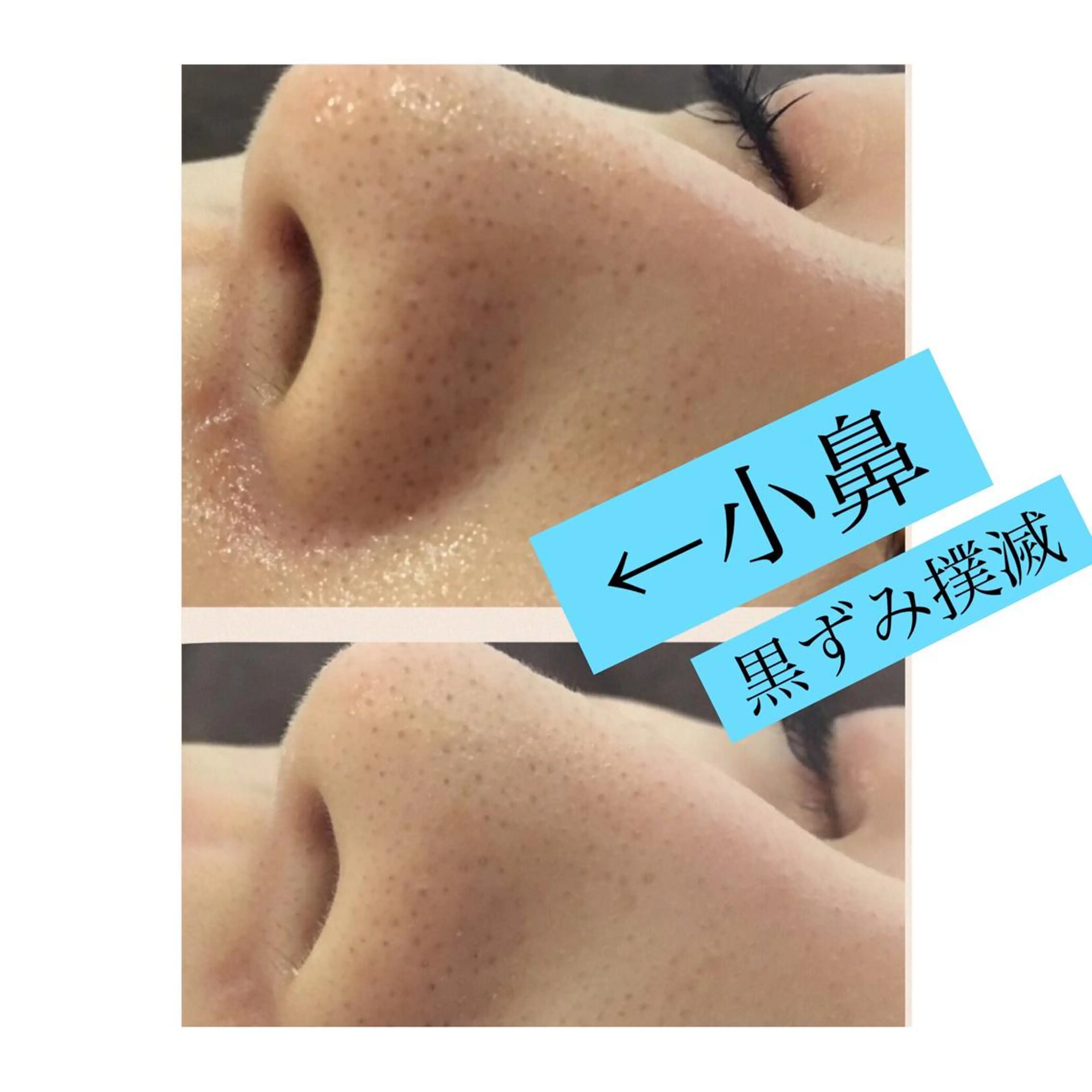 ショート カラー パーマ ヘアアレンジ メンズ キッズ ネイル マツエク・マツパ 四つ星サロン🎖 腸＆ニキビケアに特化のエステ・リラクイメージ