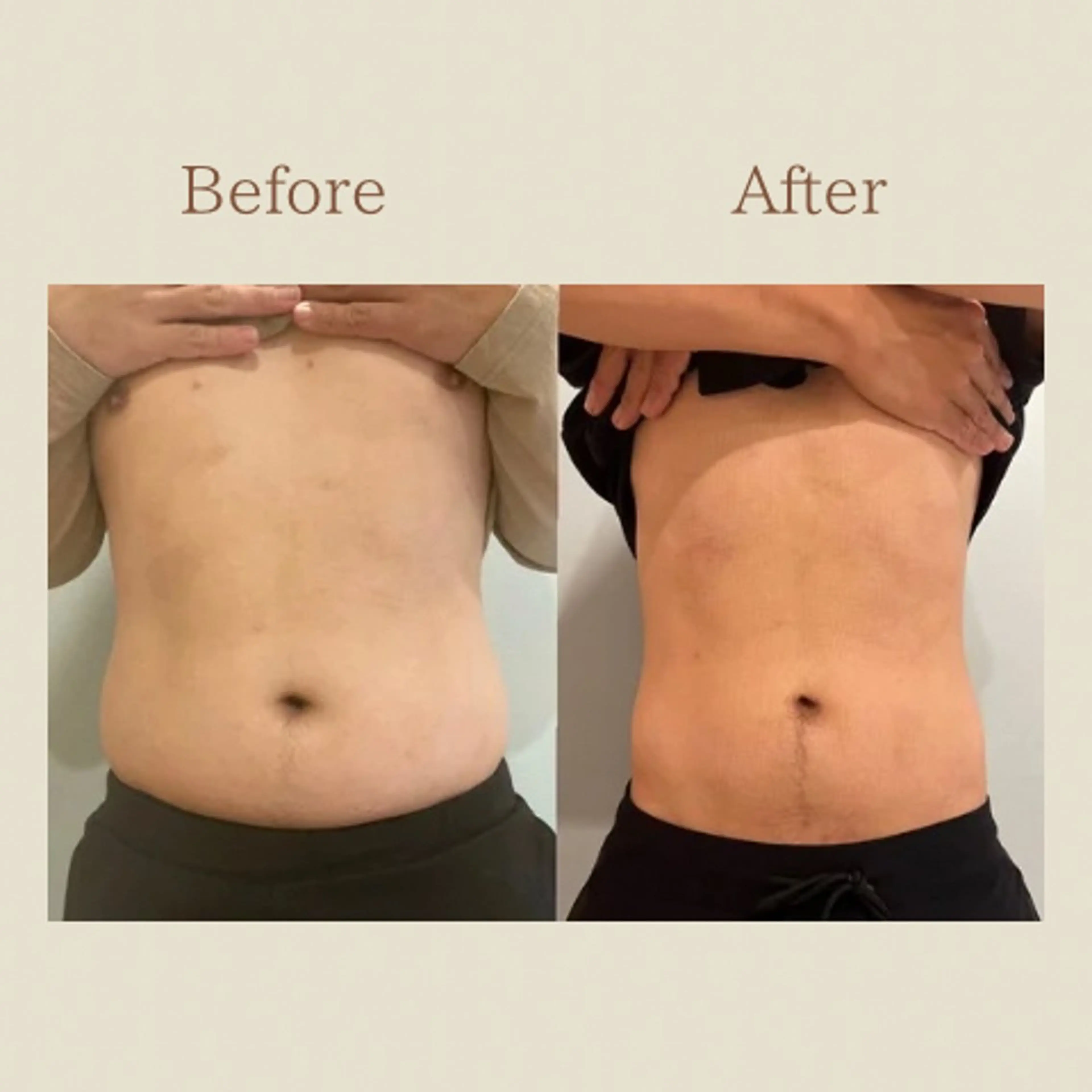 お腹痩せエステ Flat BELLY 恵比寿所属・【腸もみ/脂肪冷却】 お腹エステ/恵比寿のエステ・リラクイメージ