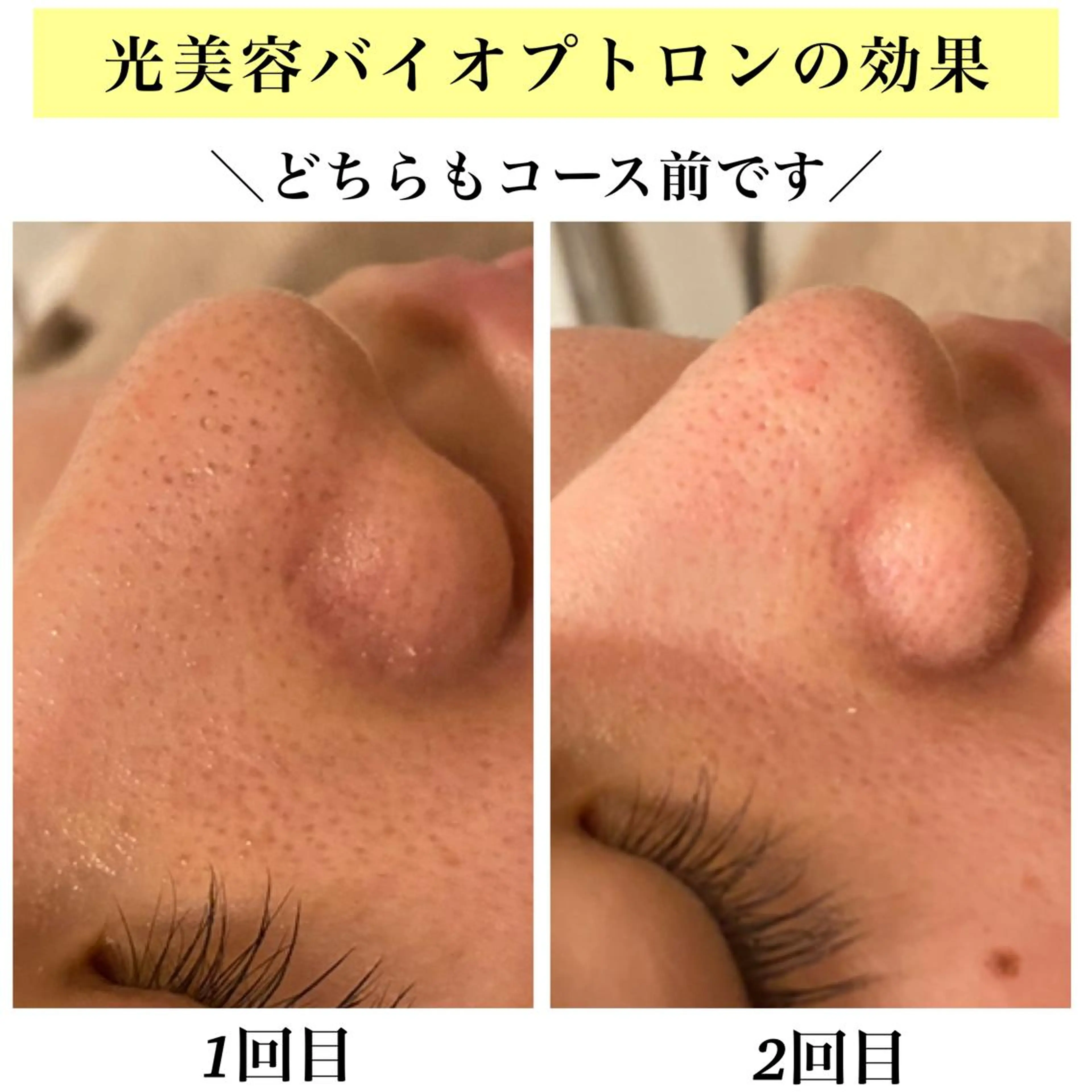 エステ リラク Bellesthe (ベルエステ)のエステ・リラクイメージ