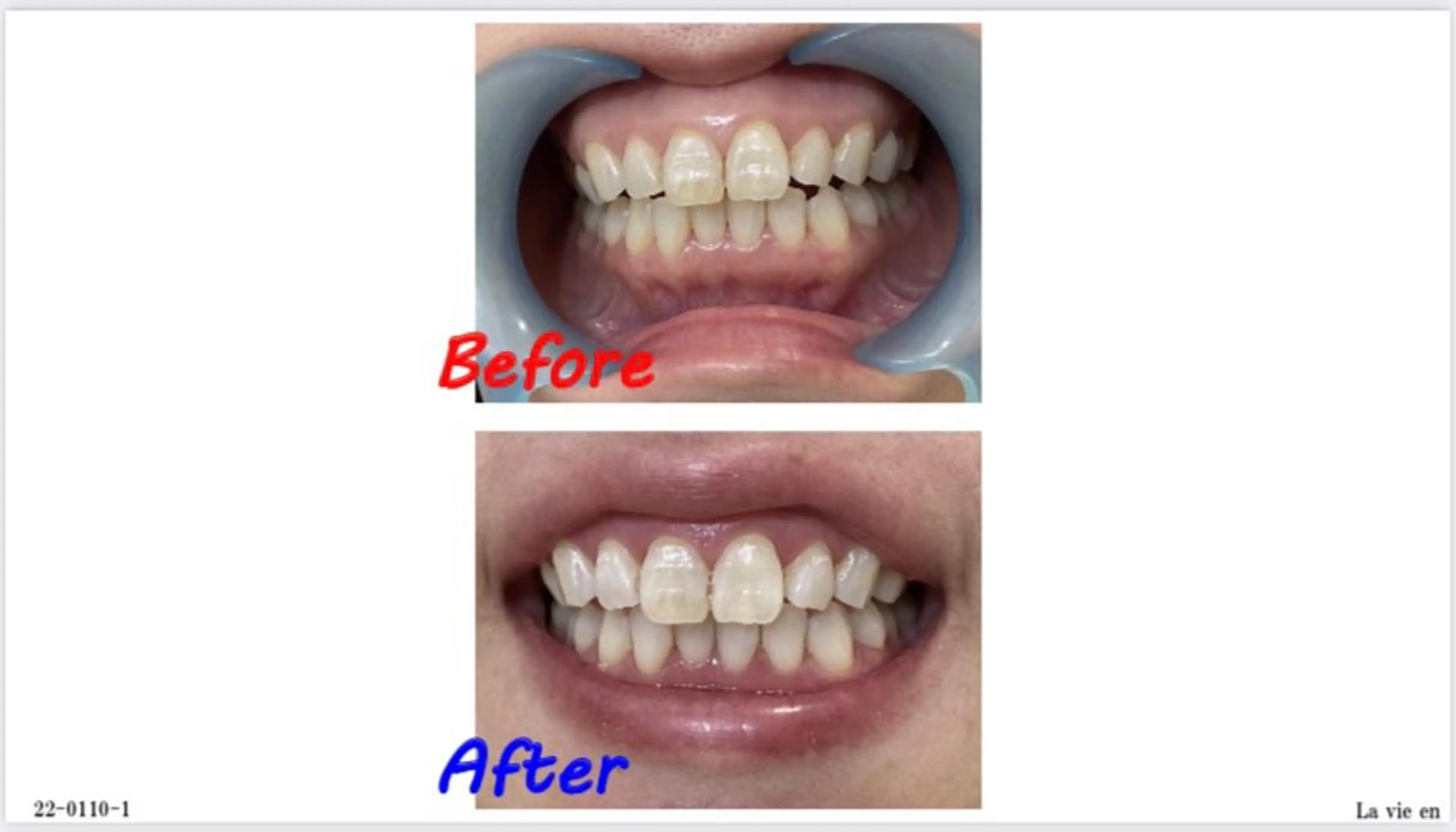 その他 セルフホワイトニングサロン　ラヴィアン所属・ホワイトニングサロン La vie enのその他イメージ