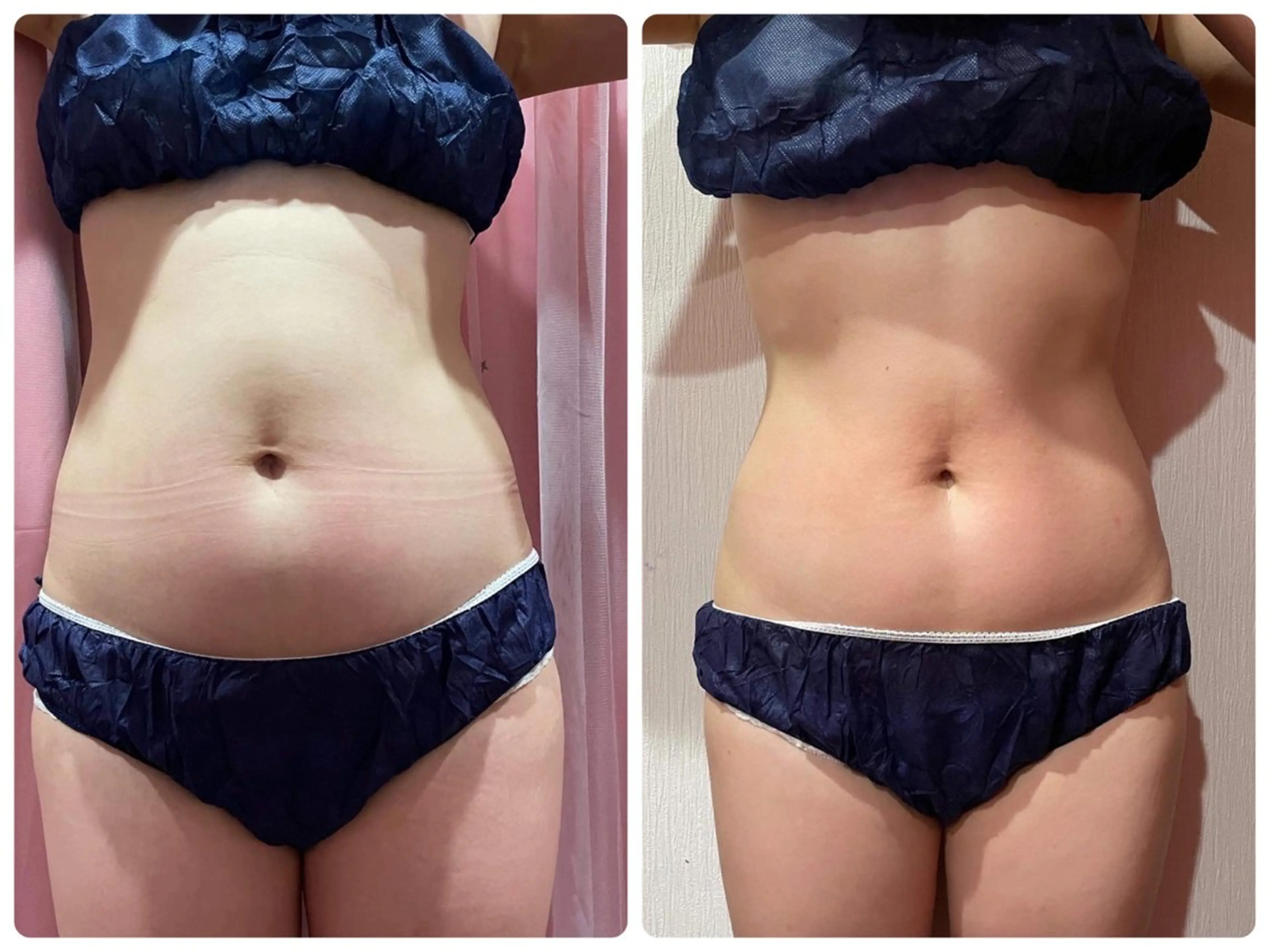 ニキビ、痩身、脱毛、 サクラチャンスパのエステ・リラクイメージ