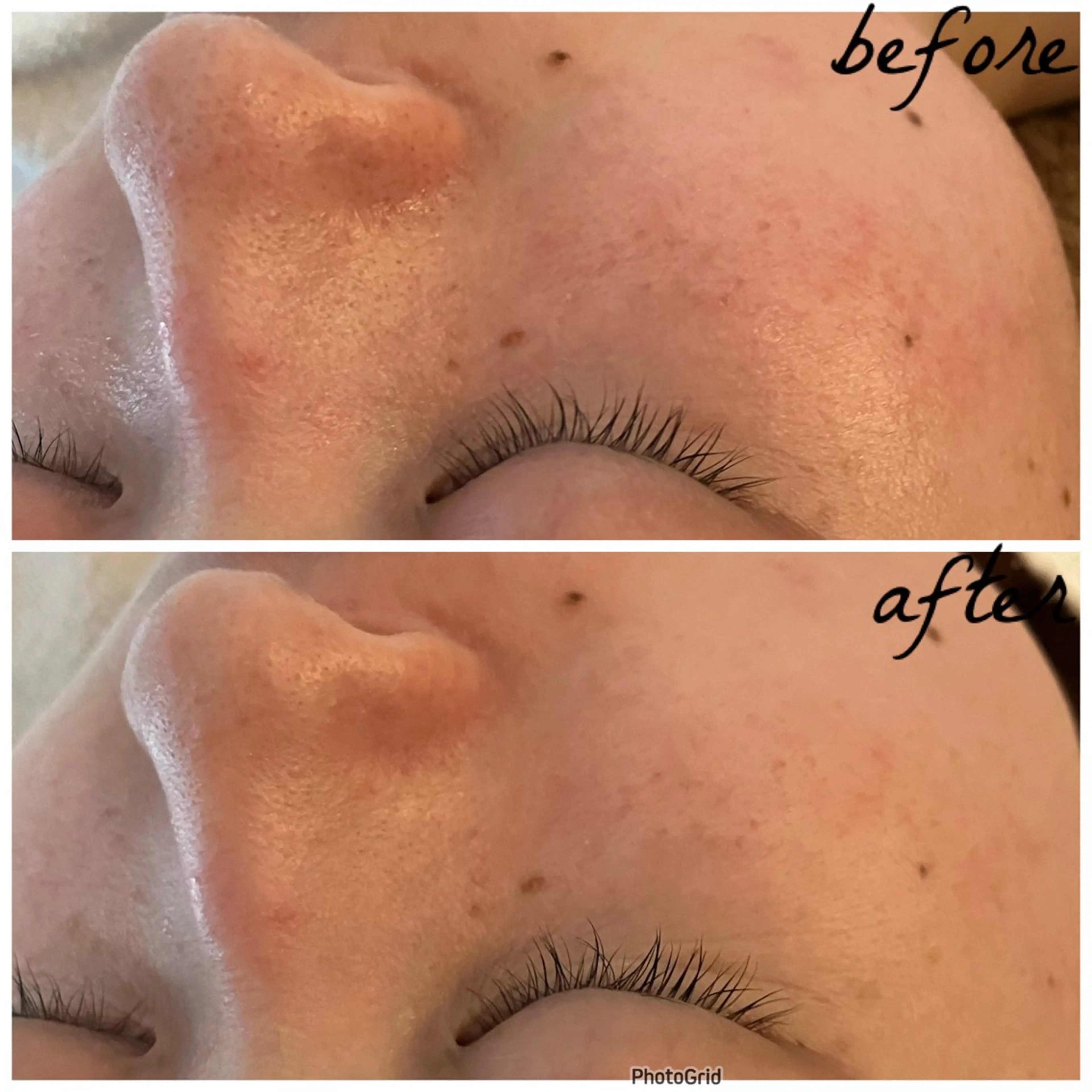 メンズ エステ メナード岐阜茜部 杉浦のエステ・リラクイメージ