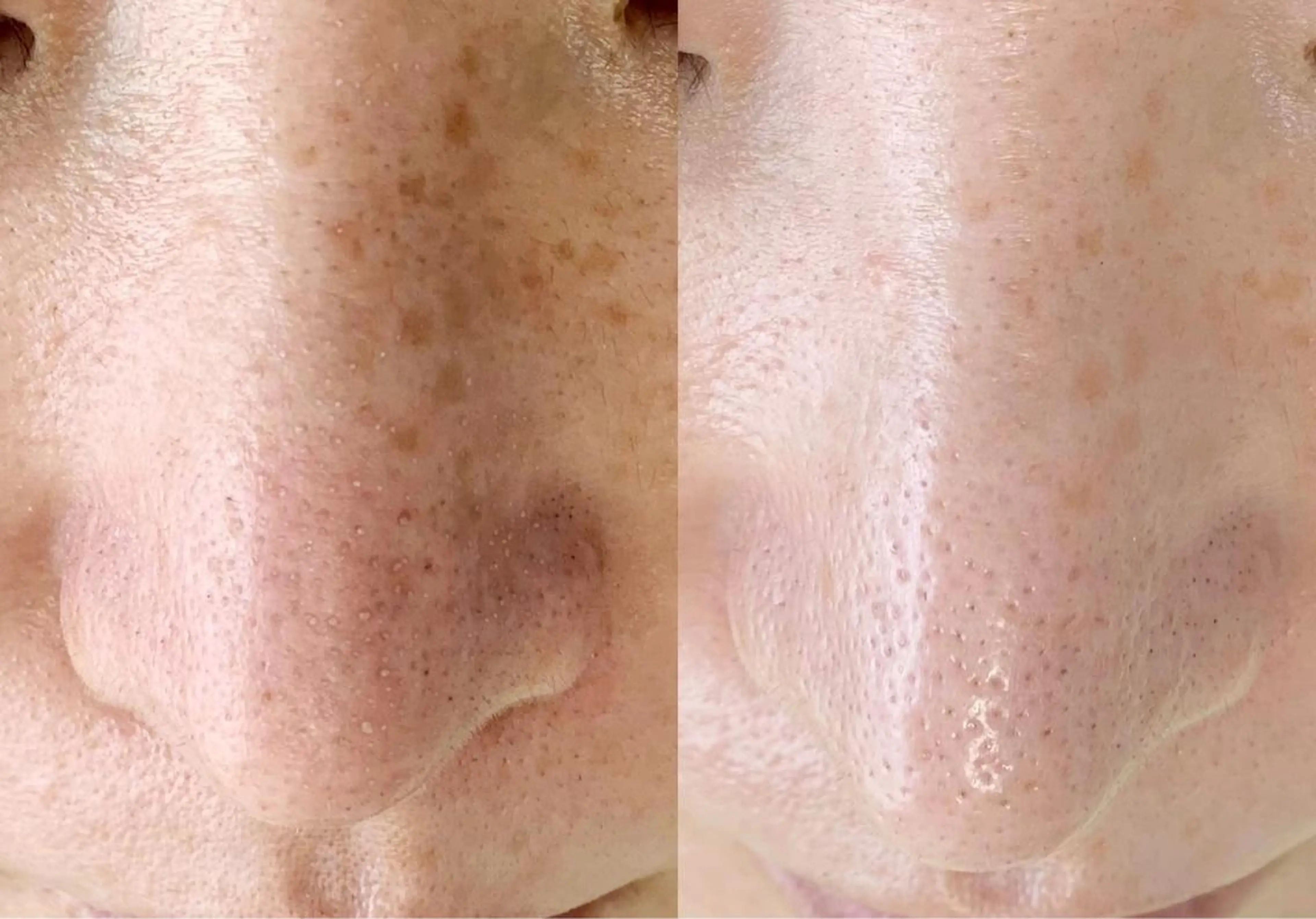 メンズ エステ salonLADYSTYLE所属・稲嶺 美華のエステ・リラクイメージ