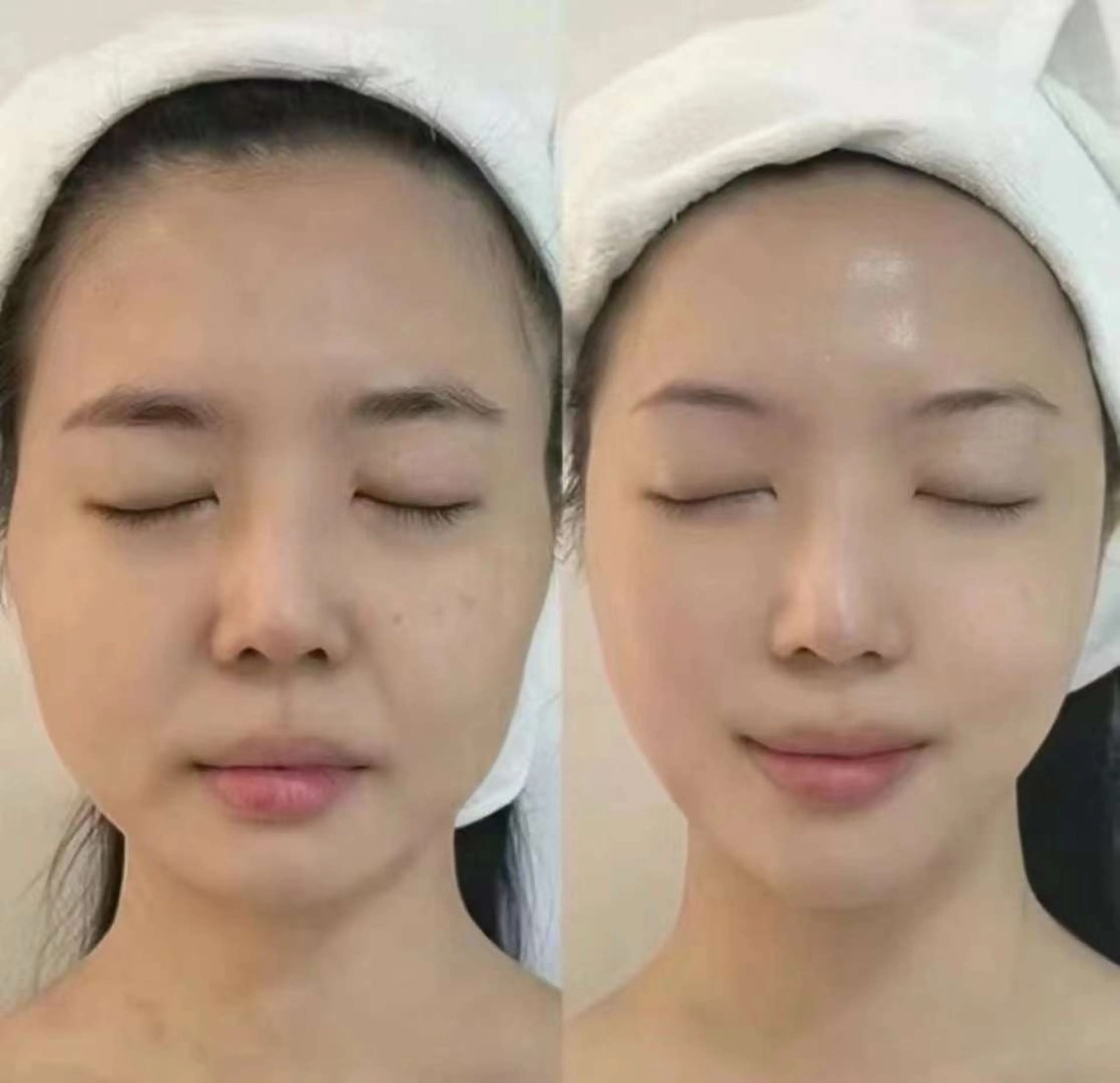 マツエク・マツパ 結婚式・ブライダル エステ aliaハイフ&水光ジェットサロン所属・aliaハーブ水光店 エステティシャン募集のエステ・リラクイメージ