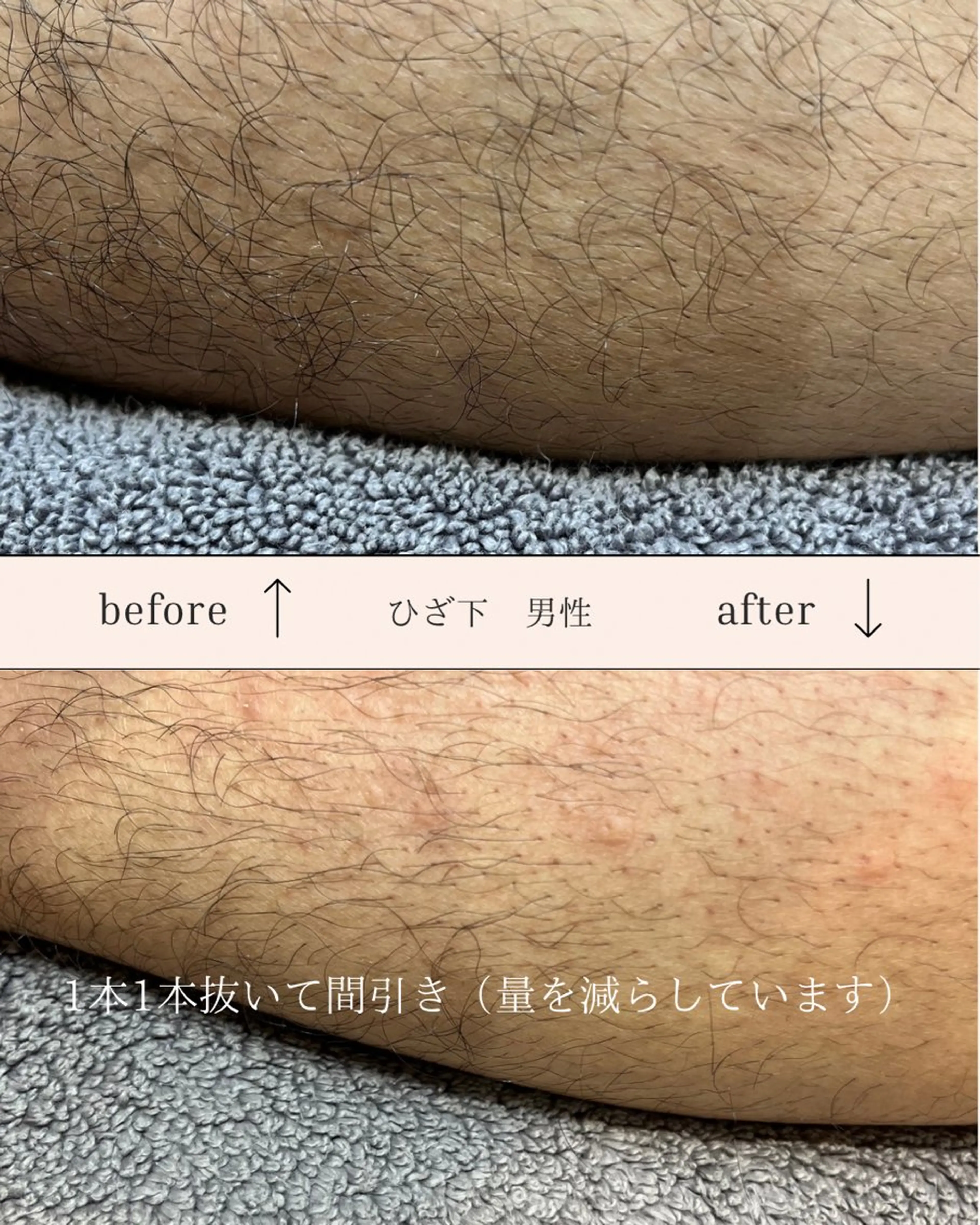 EPI Studioのエステ・リラクイメージ