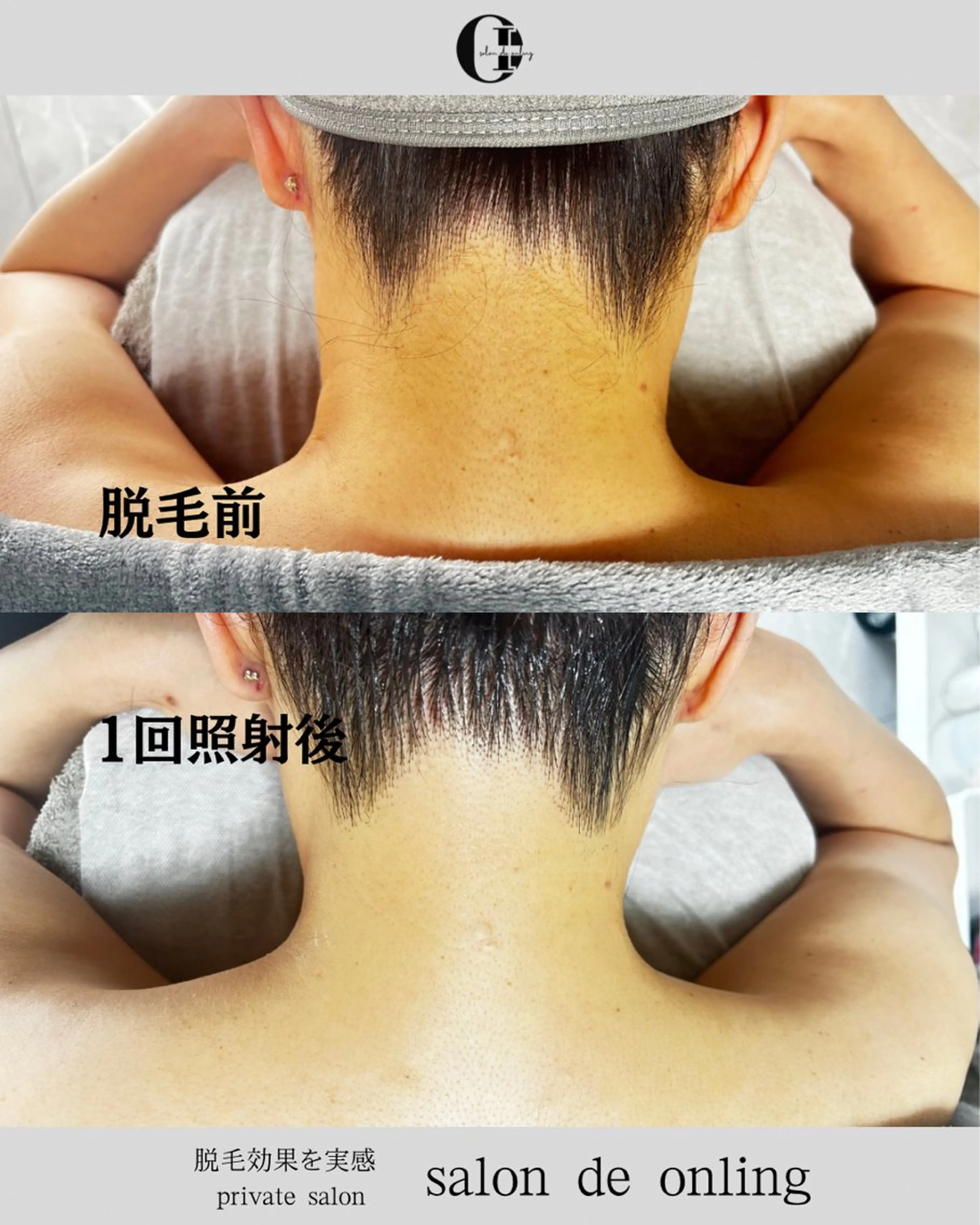 脱毛 salon  de onlingのエステ・リラクイメージ