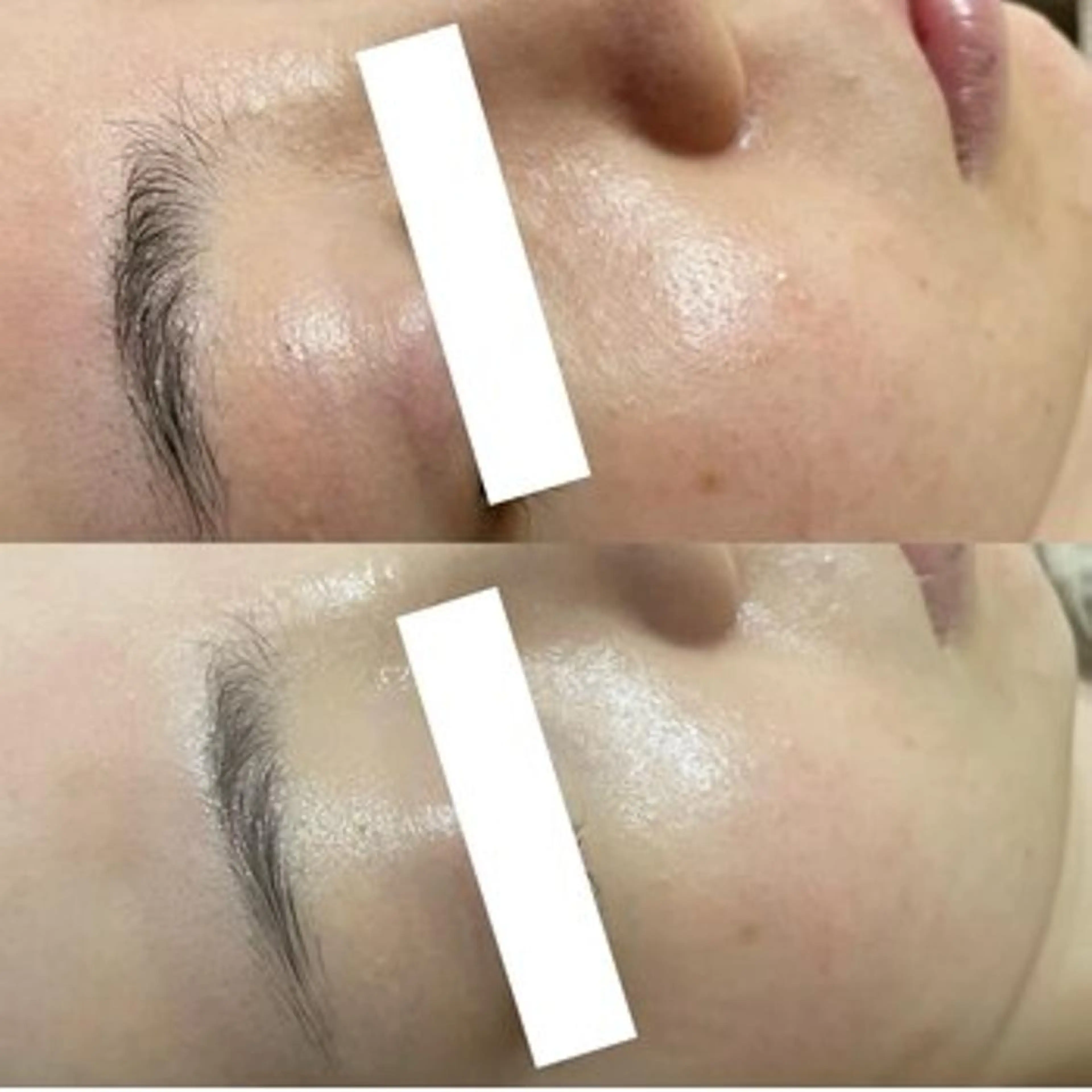 毛穴/小顔専門♡ アトリエリュバンのエステ・リラクイメージ