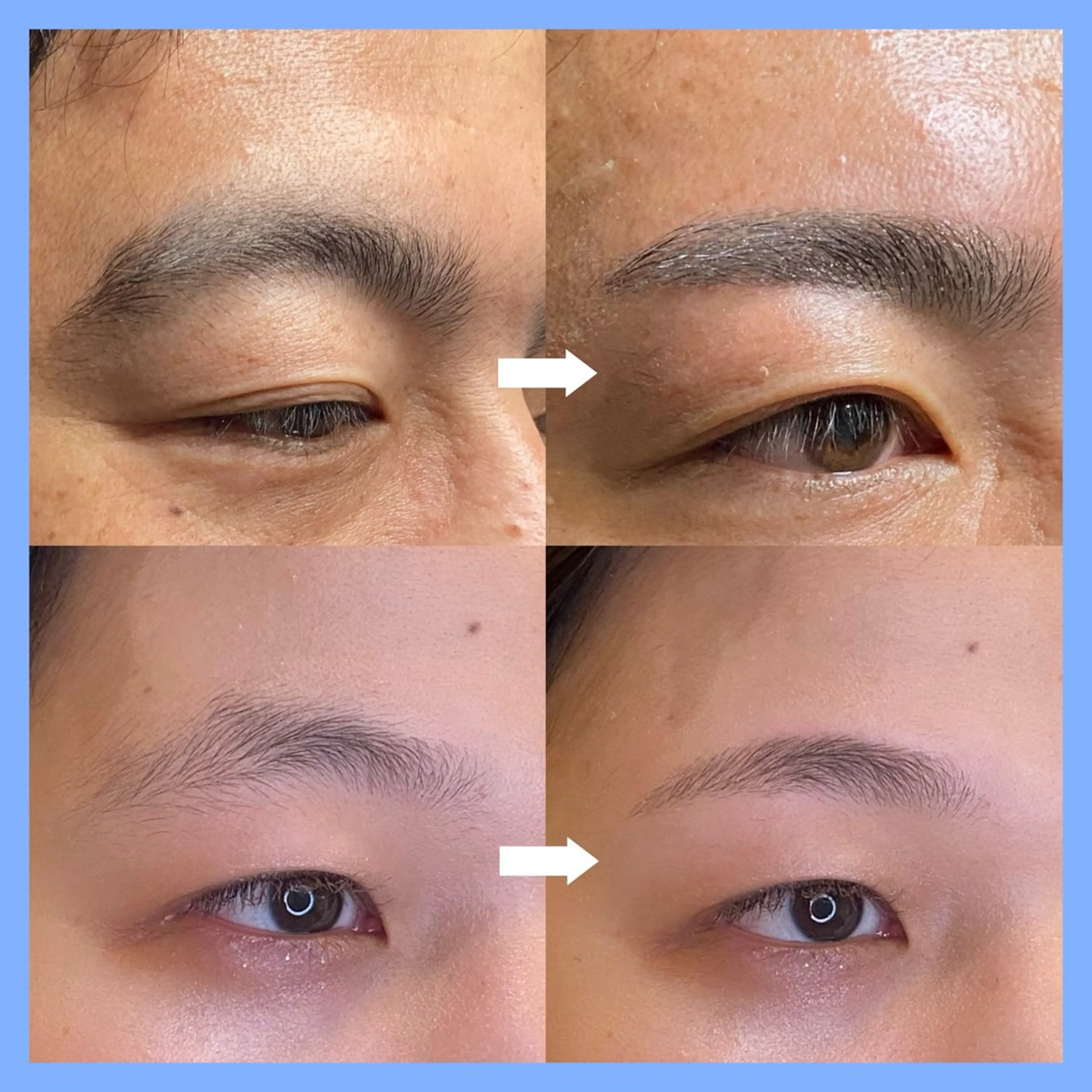 《本日限定！》整顔眉アイブロウWAX脱毛の写真