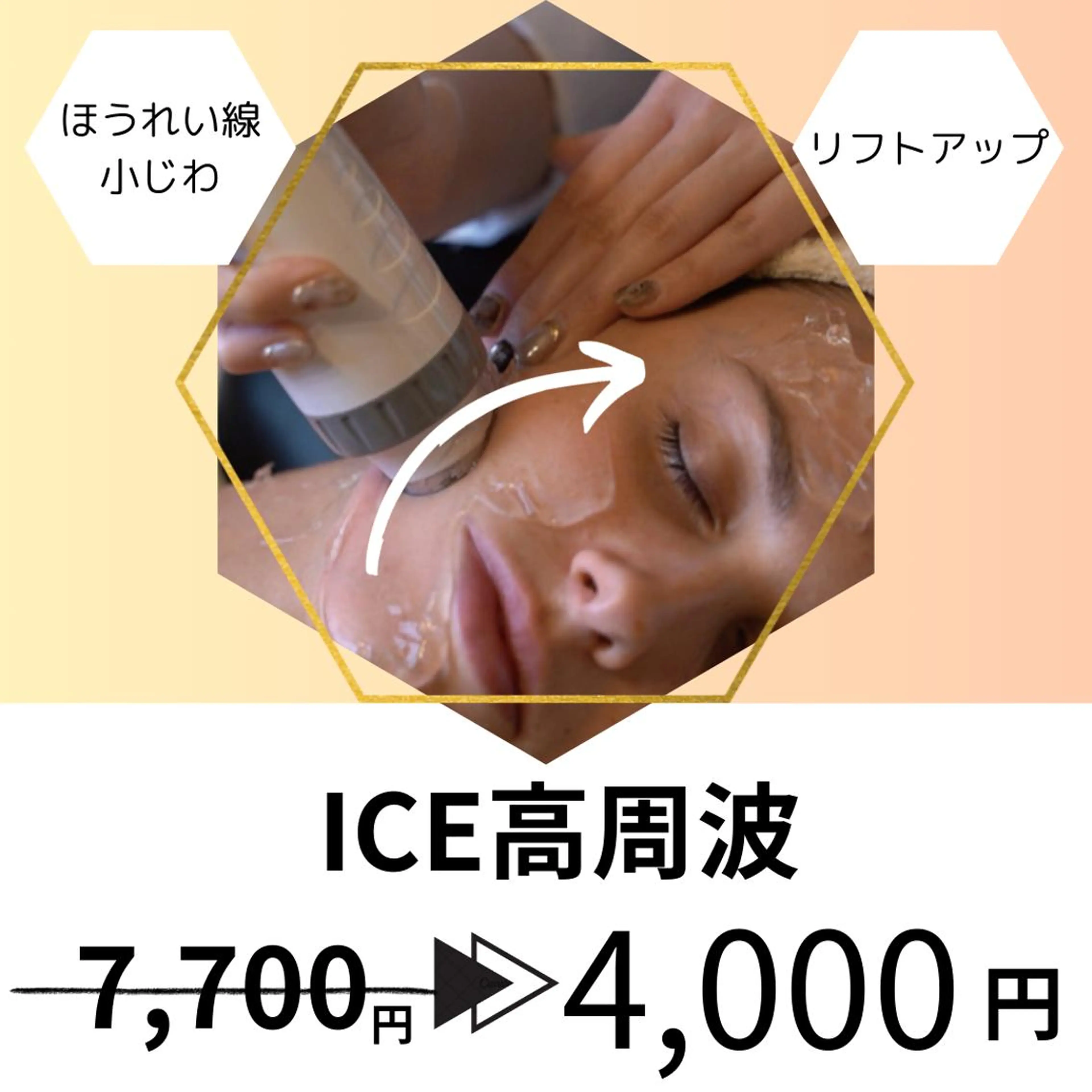 20代から始める脱毛 salonLEPIAのエステ・リラクイメージ