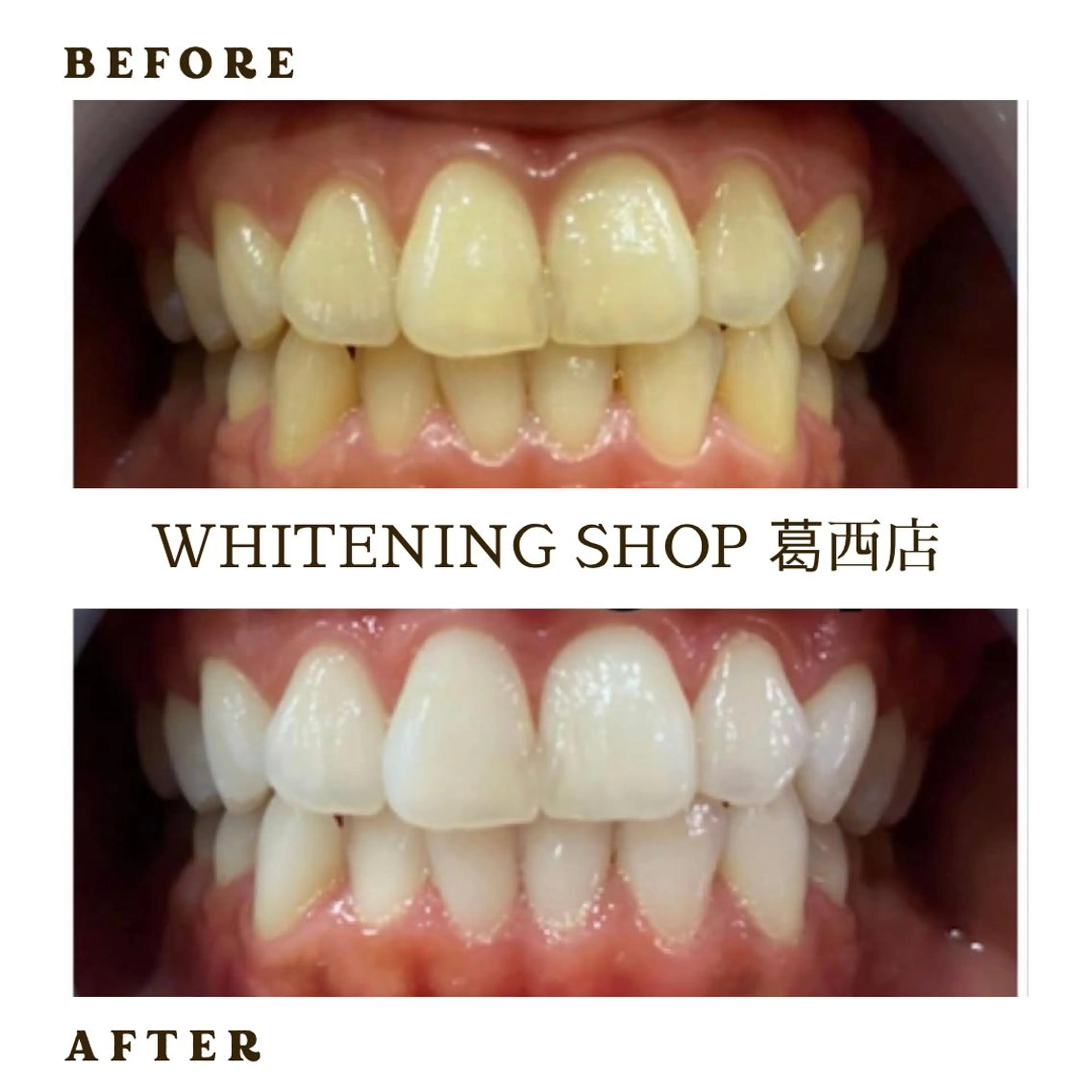 メンズ その他 ホワイトニング ショップ葛西店のその他イメージ