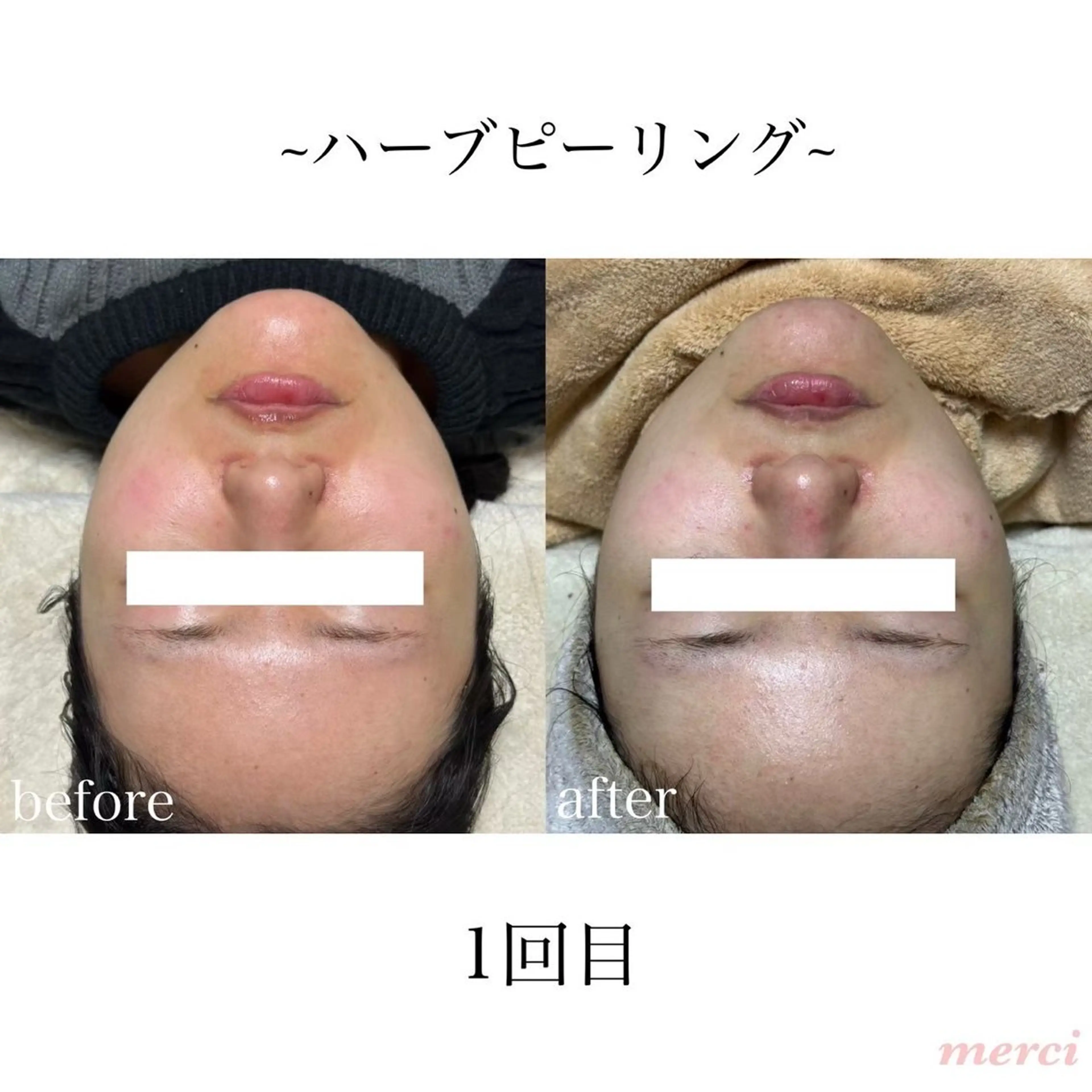 salon merciのエステ・リラクイメージ