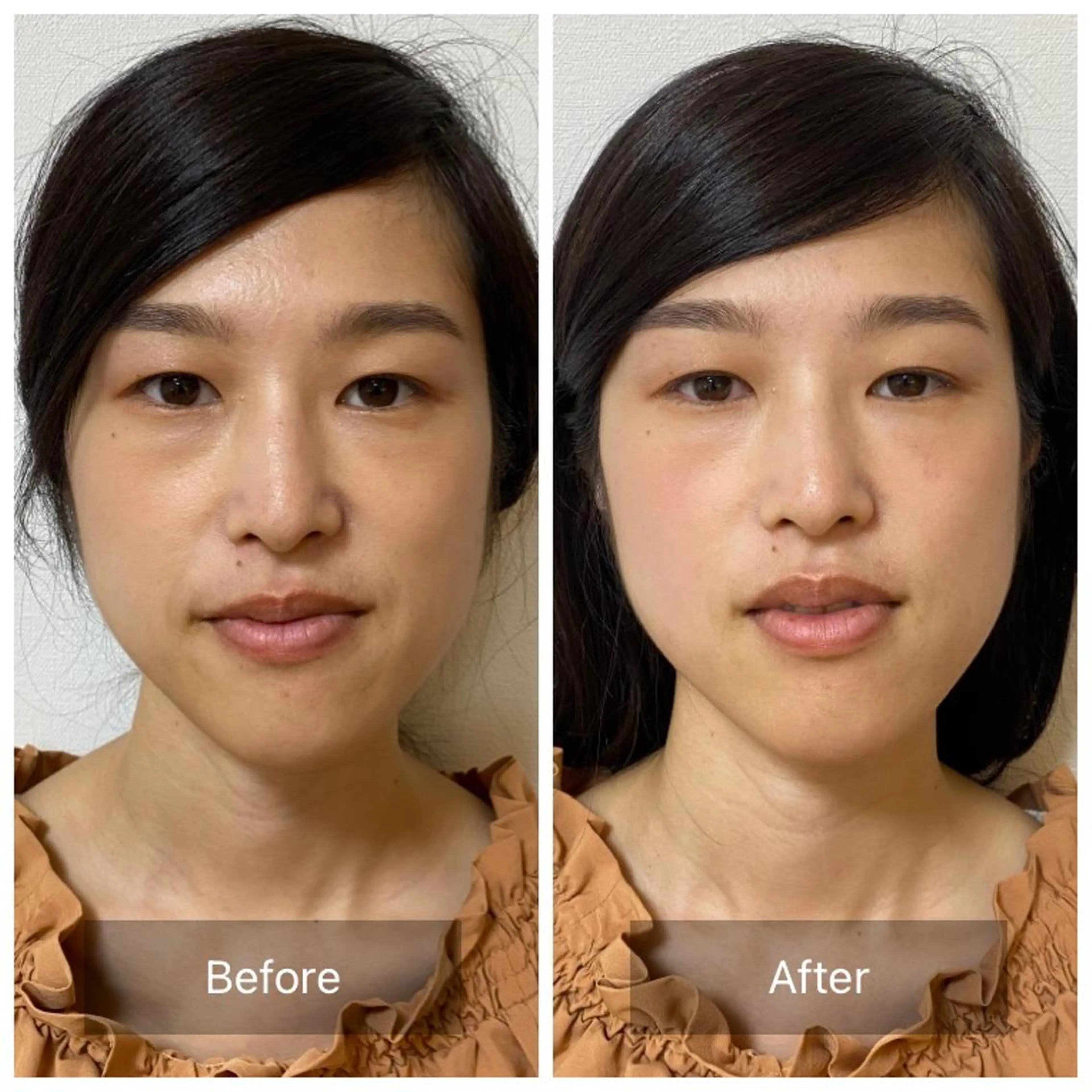 そとやまのはり おきゅう所属・外山 勝敏のエステ・リラクイメージ