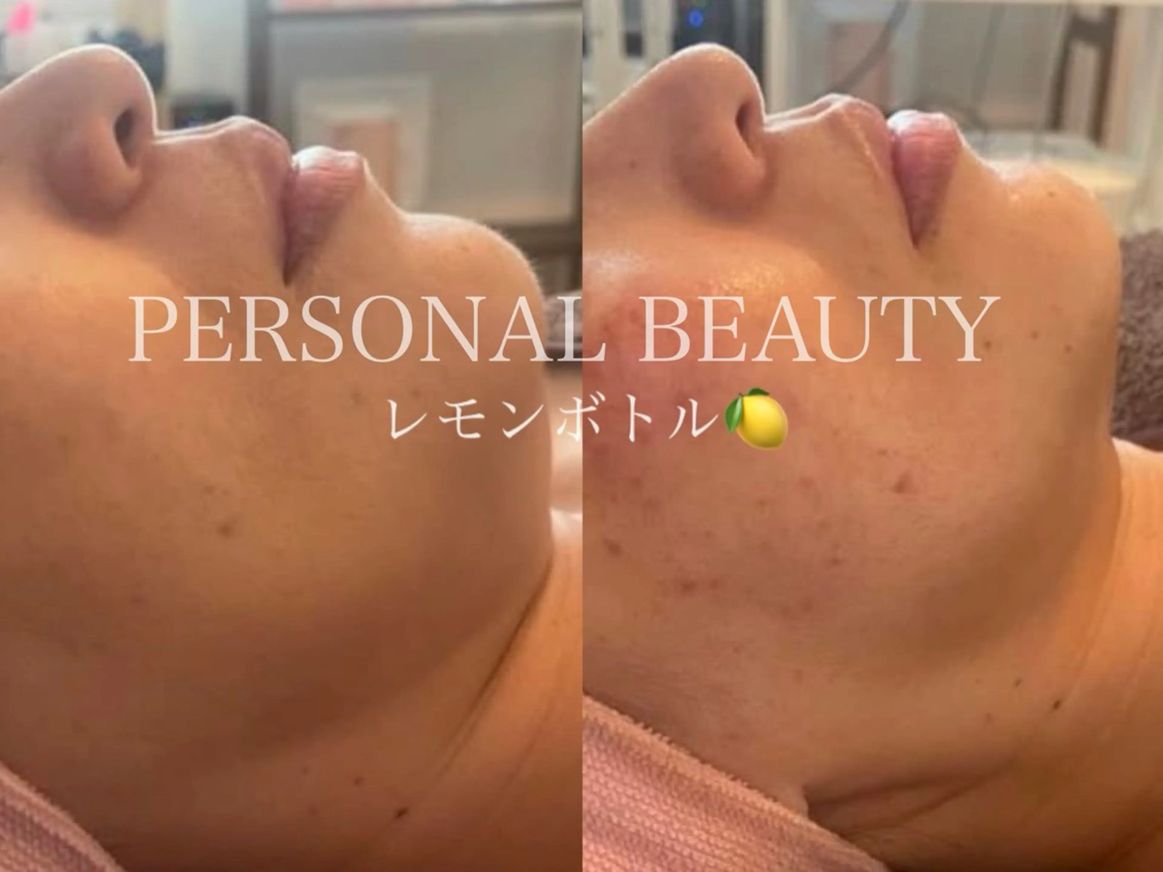PERSONAL BEAUTY🪻のエステ・リラクイメージ
