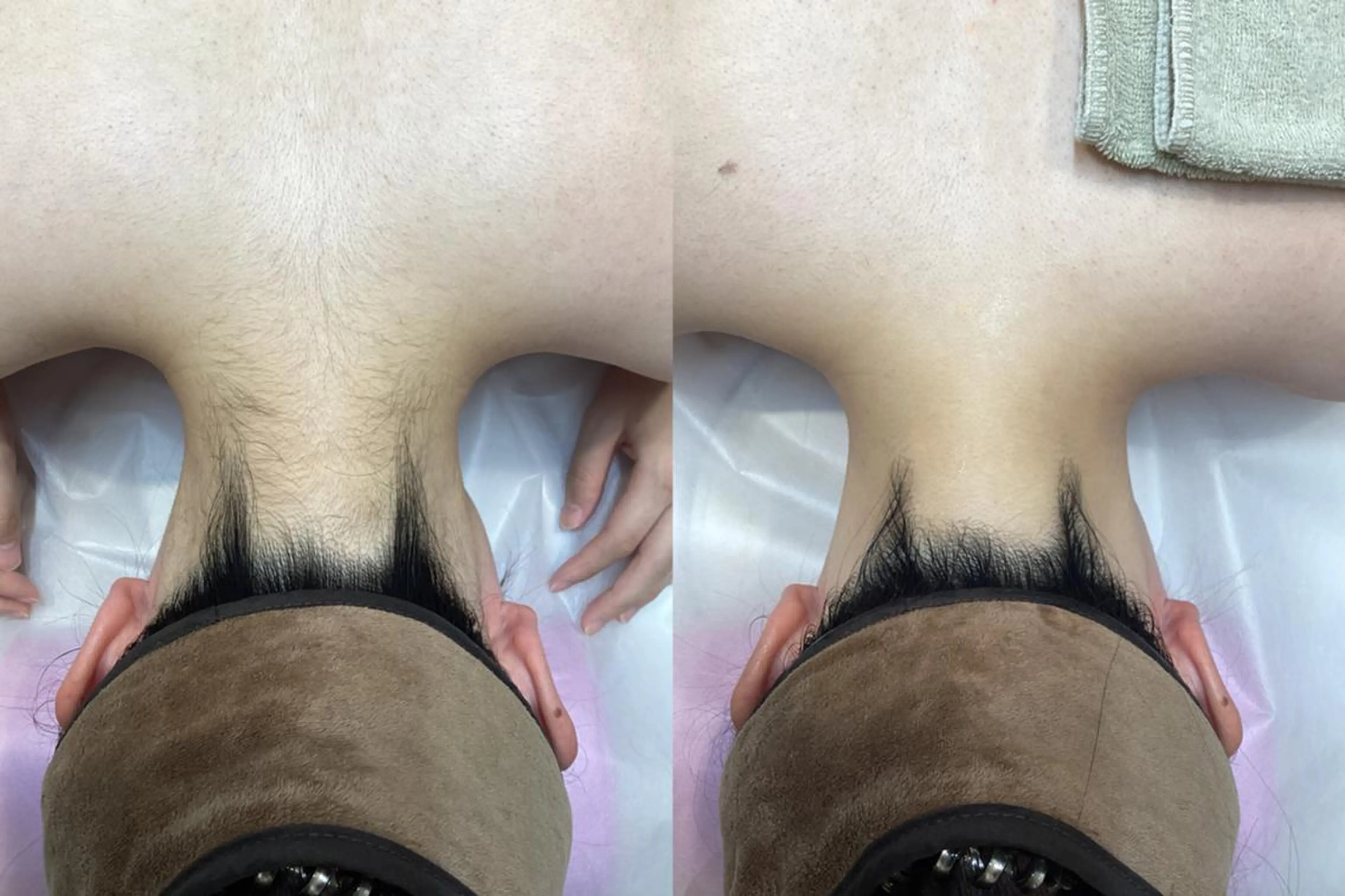 脱毛 U24💗学割エステ 💗RAYVIS池袋のエステ・リラクイメージ