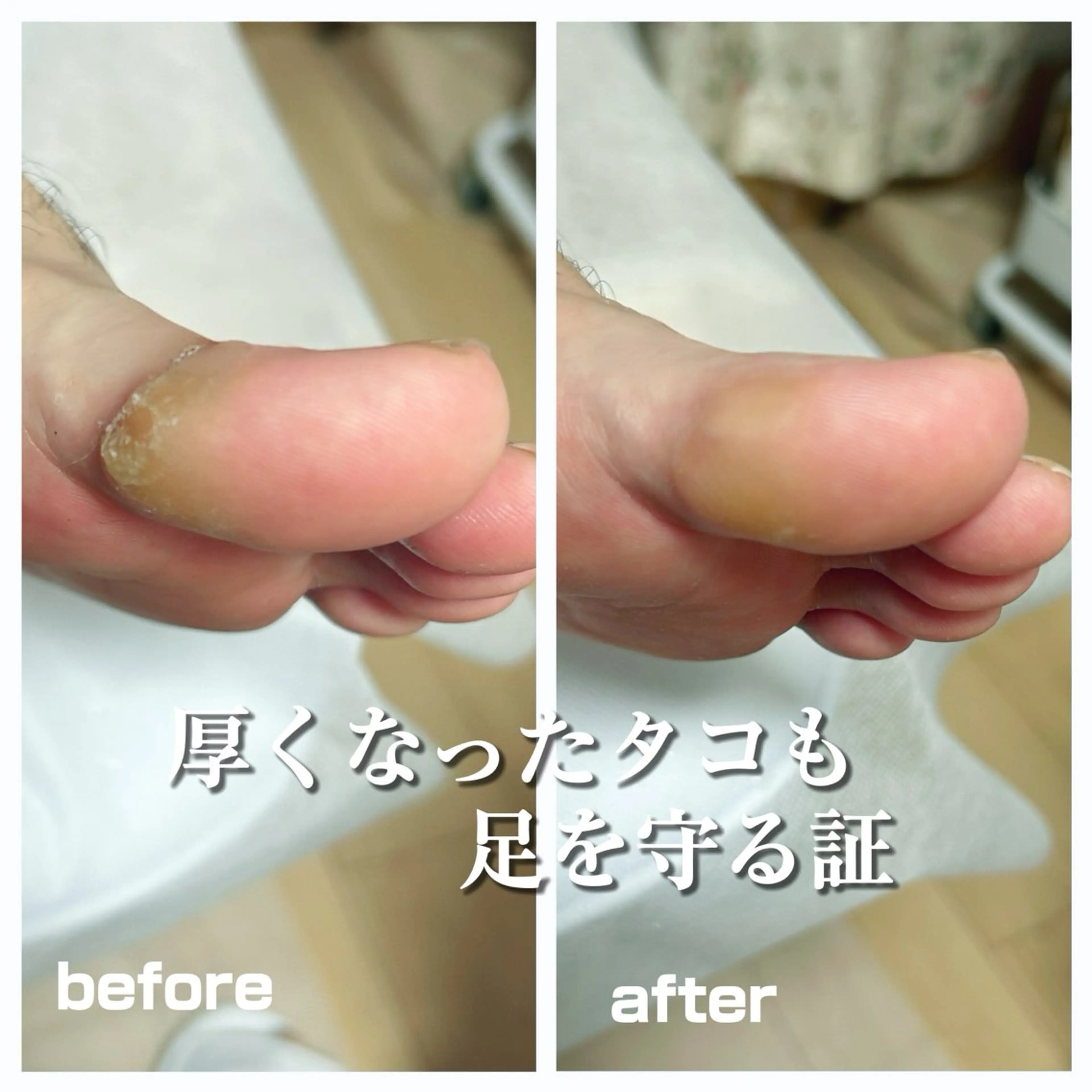 その他 巻き爪フットケアサロンKotori所属・フットケアサロン Kotoriのその他イメージ