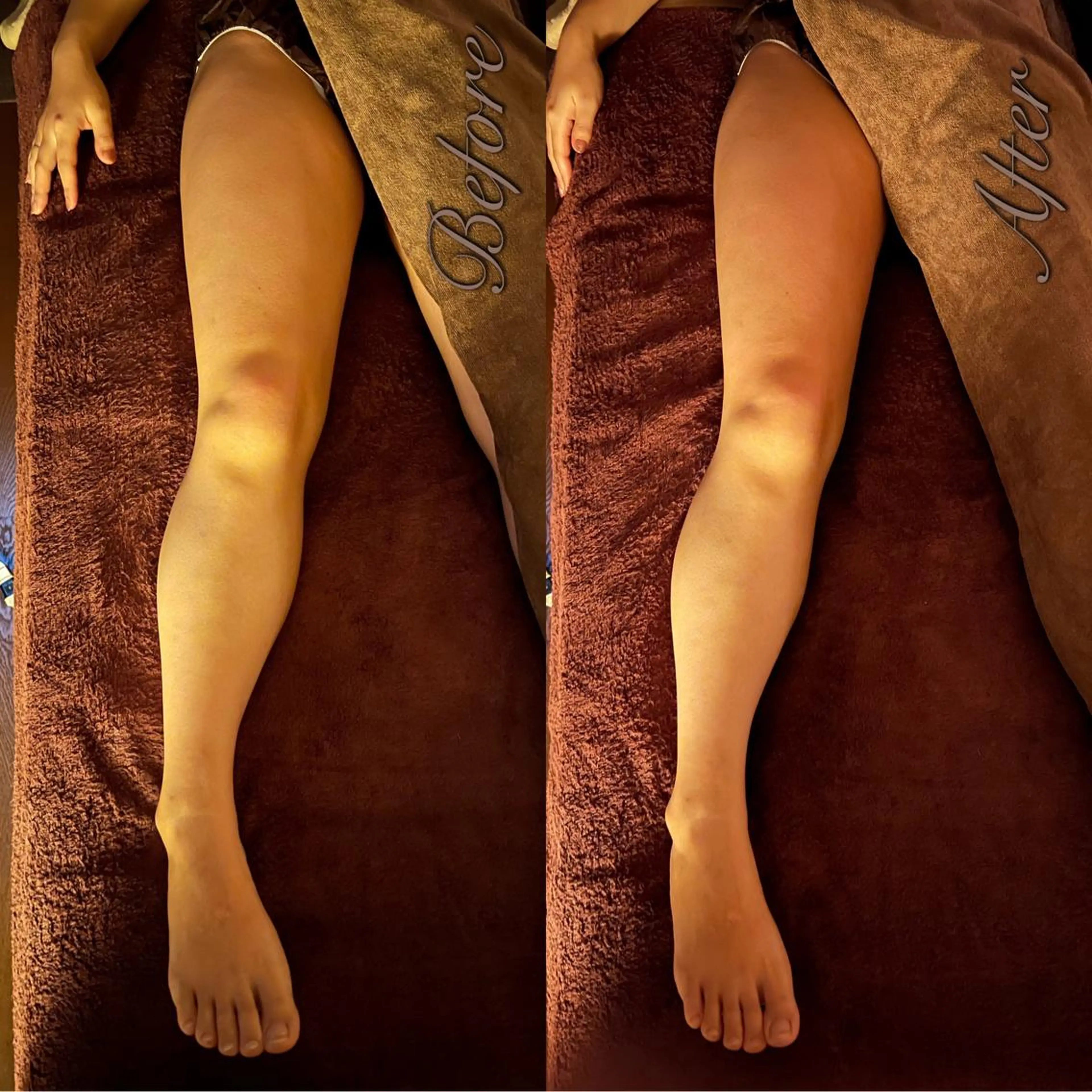 エステ リラク lymph care 'Welnəsのエステ・リラクイメージ