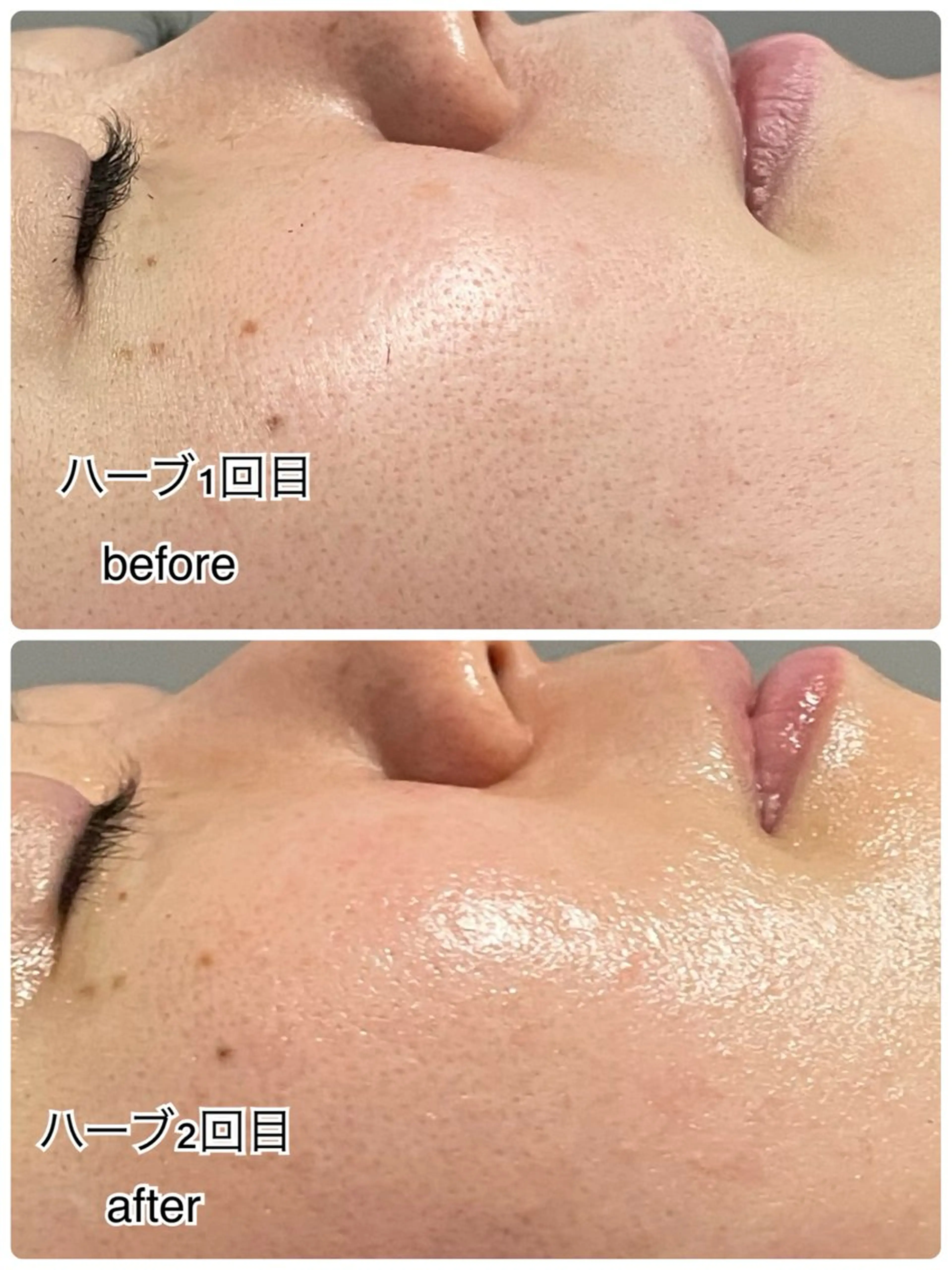 その他 ENCHANT 脱毛.小顔.毛穴のエステ・リラクイメージ