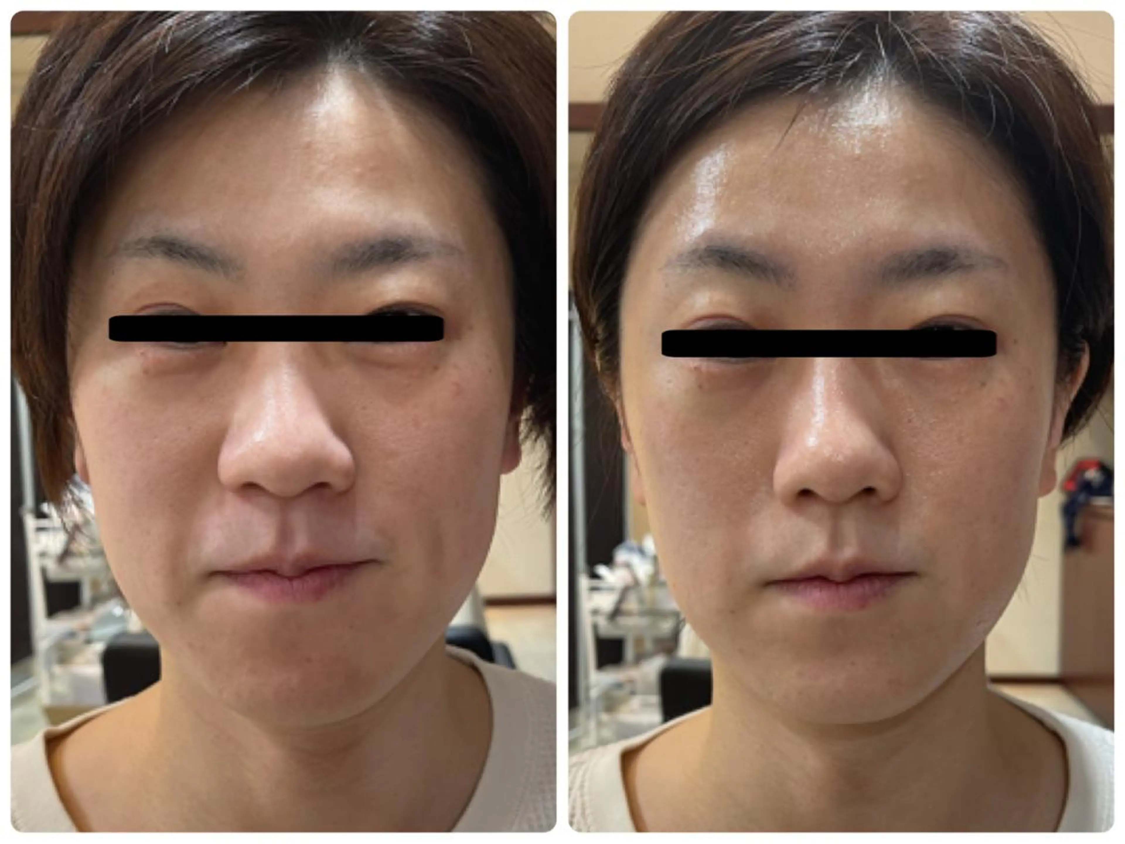 Eyelash Salon 4Uのマツエク・マツパデザイン