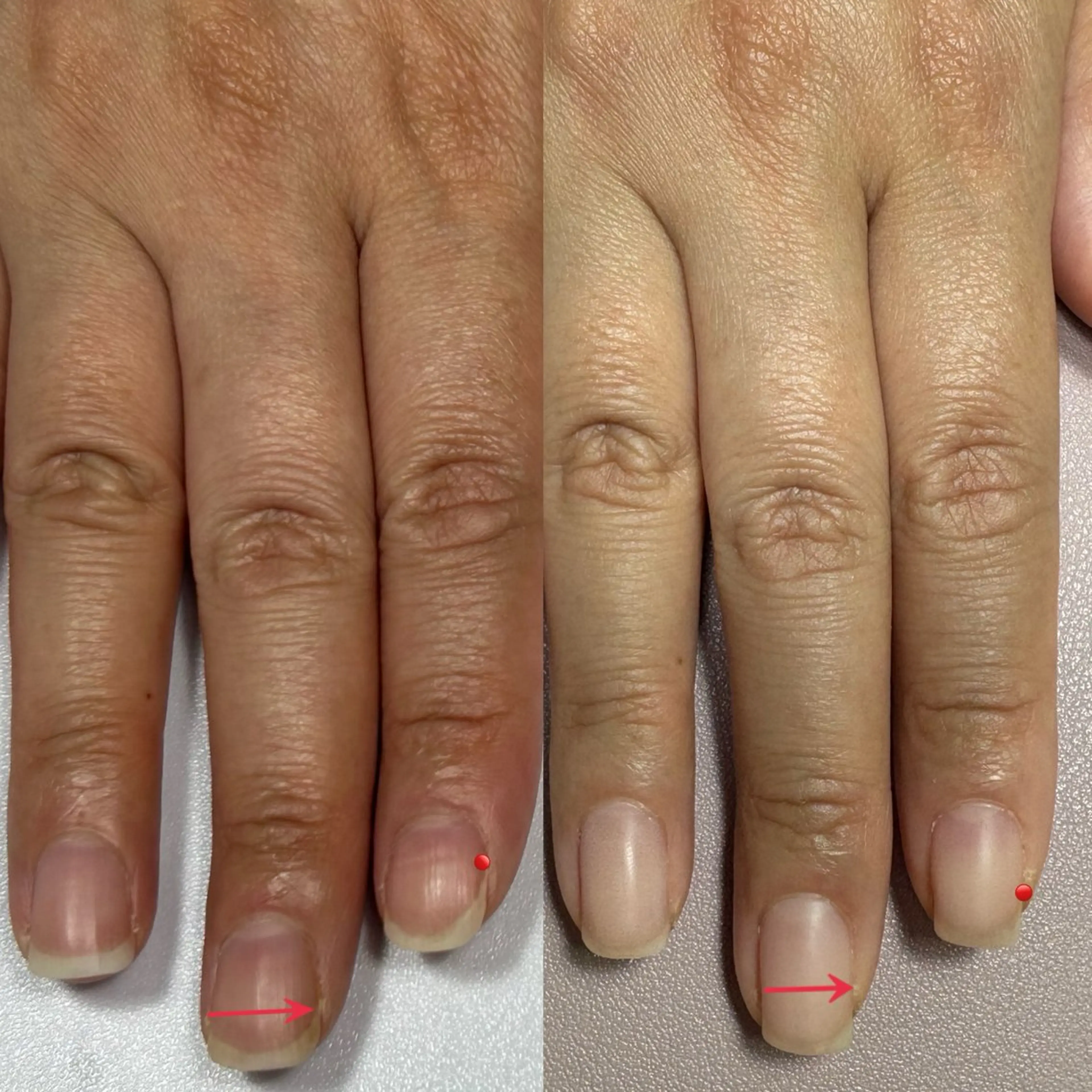 ネイル nail salon ikuneのネイルデザイン