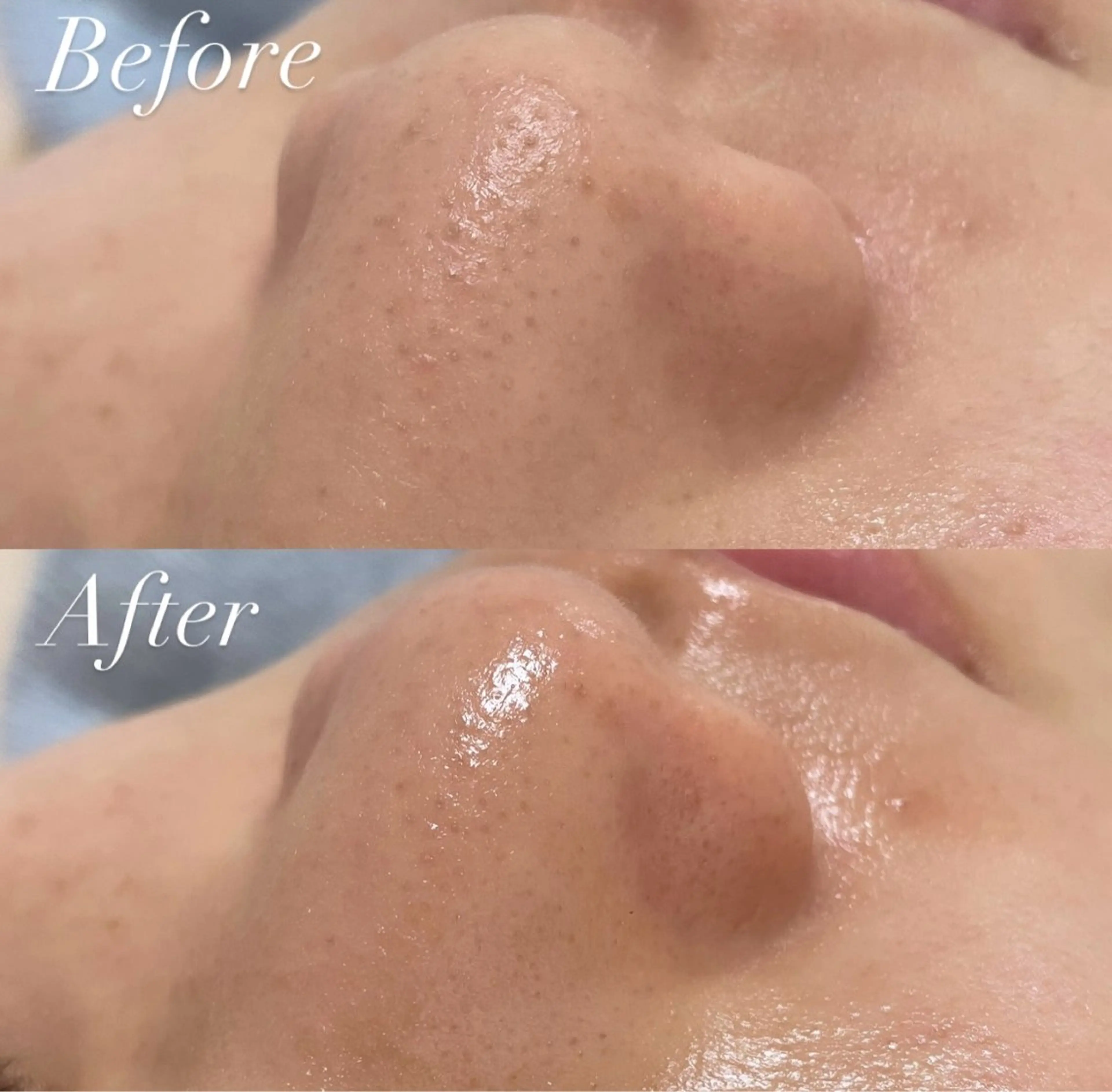 エステ リラク プライベートサロン Belle(ベル)のエステ・リラクイメージ