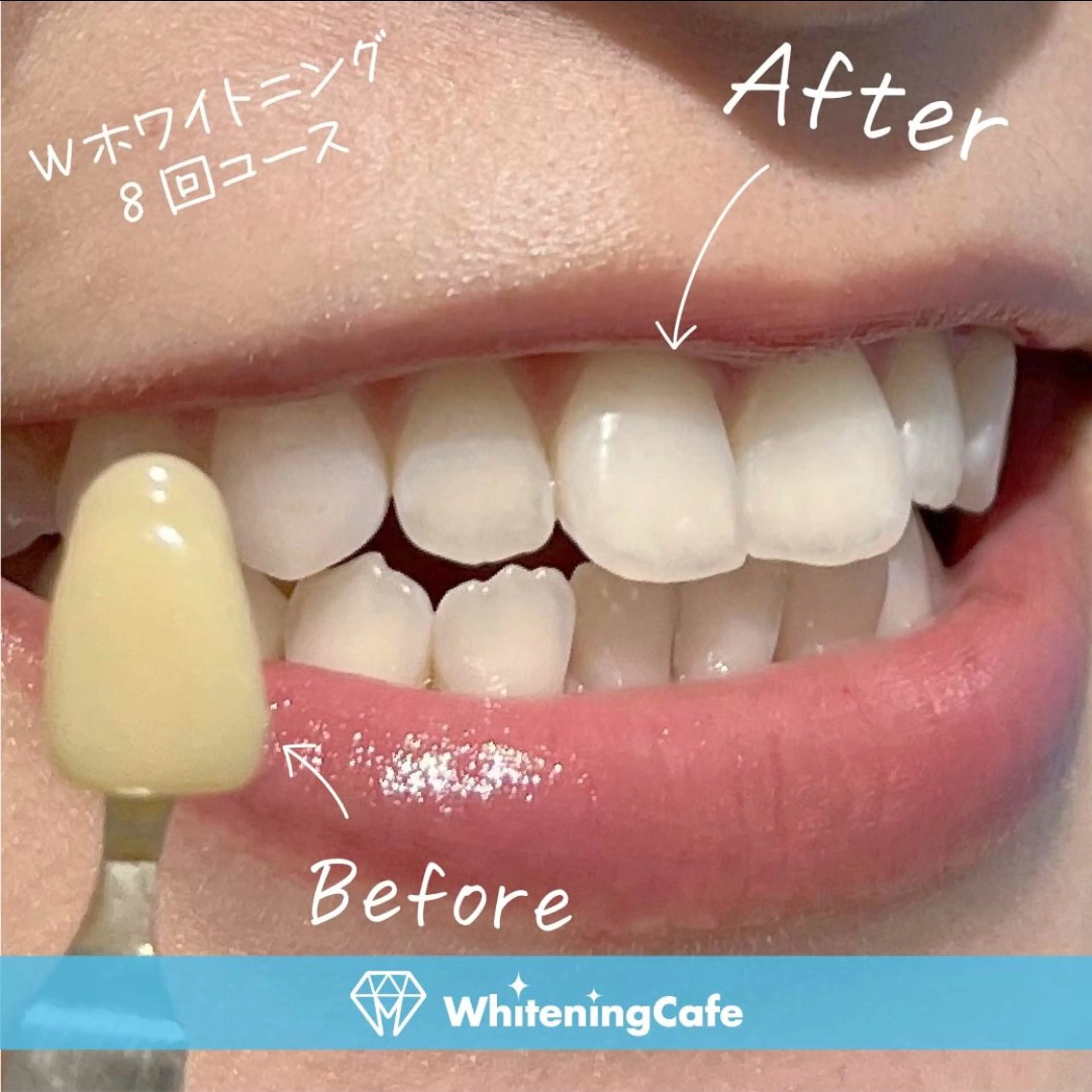 ホワイトニングカフェ神戸元町店所属・ホワイトニングカフェ 神戸元町店のエステ・リラクイメージ