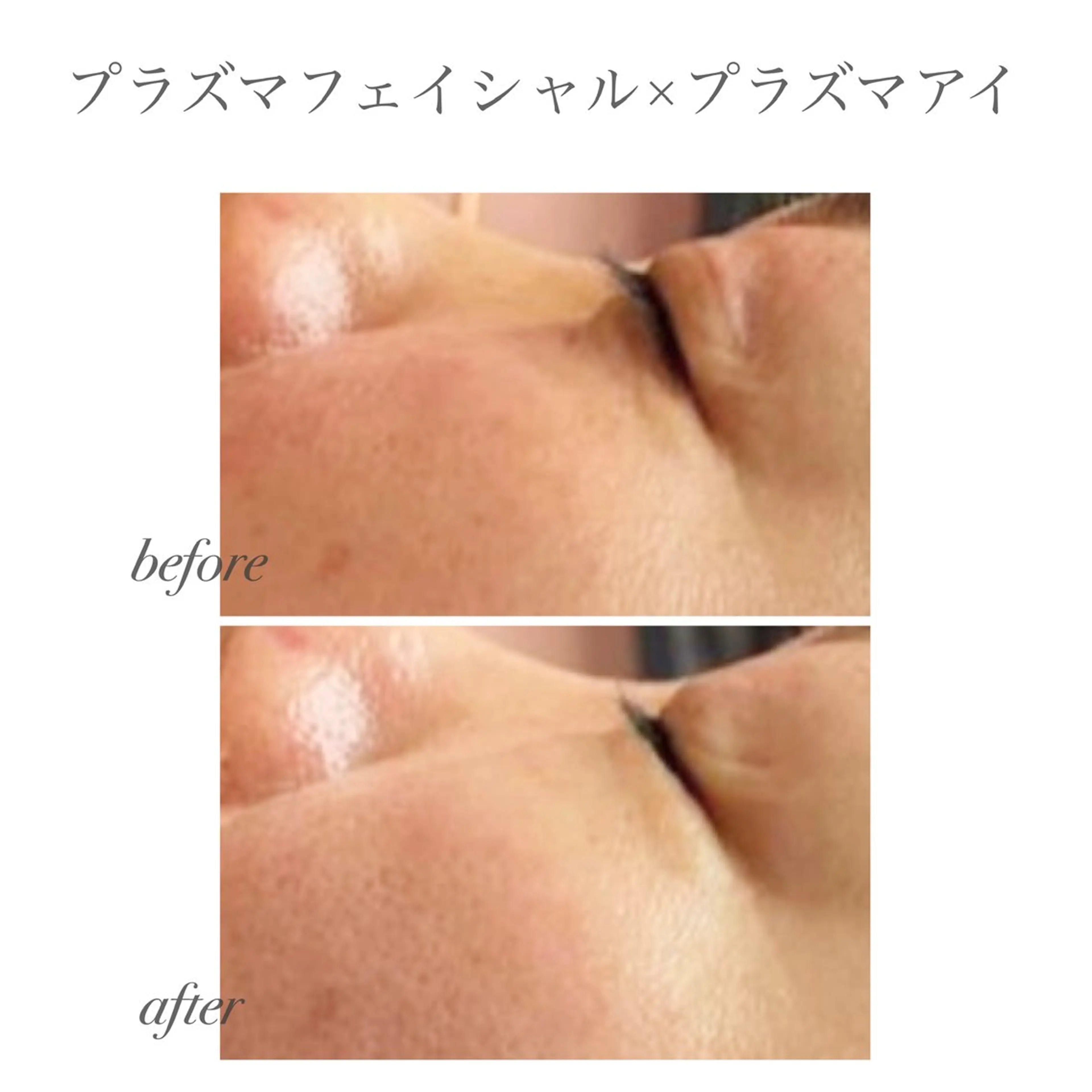 Lily branc 痩身/小顔/肌質改善のエステ・リラクイメージ