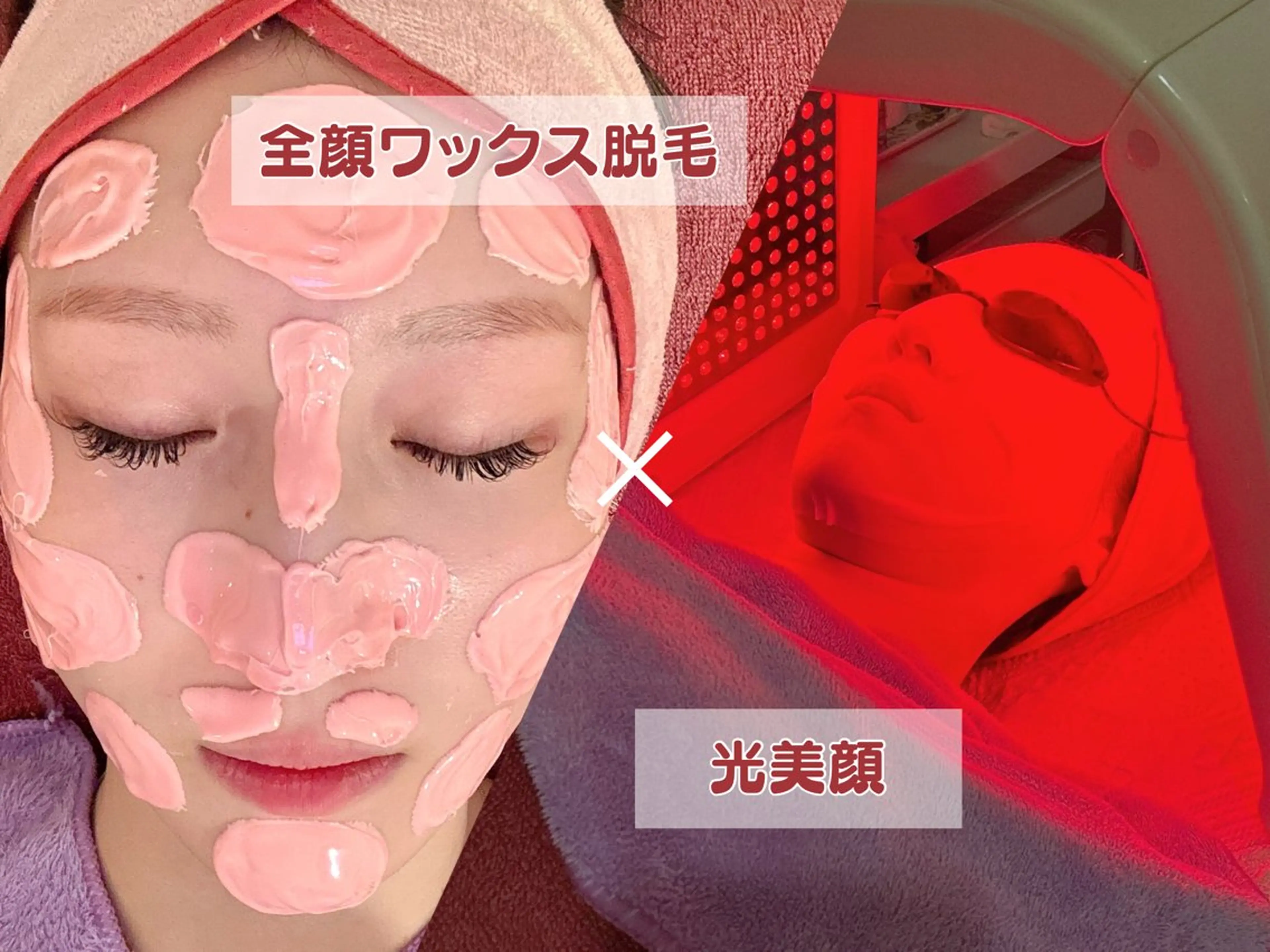 【つるん美肌コース🌸】全顔WAX＋光美顔＋保湿パック 60分 ¥4,500🪄の写真
