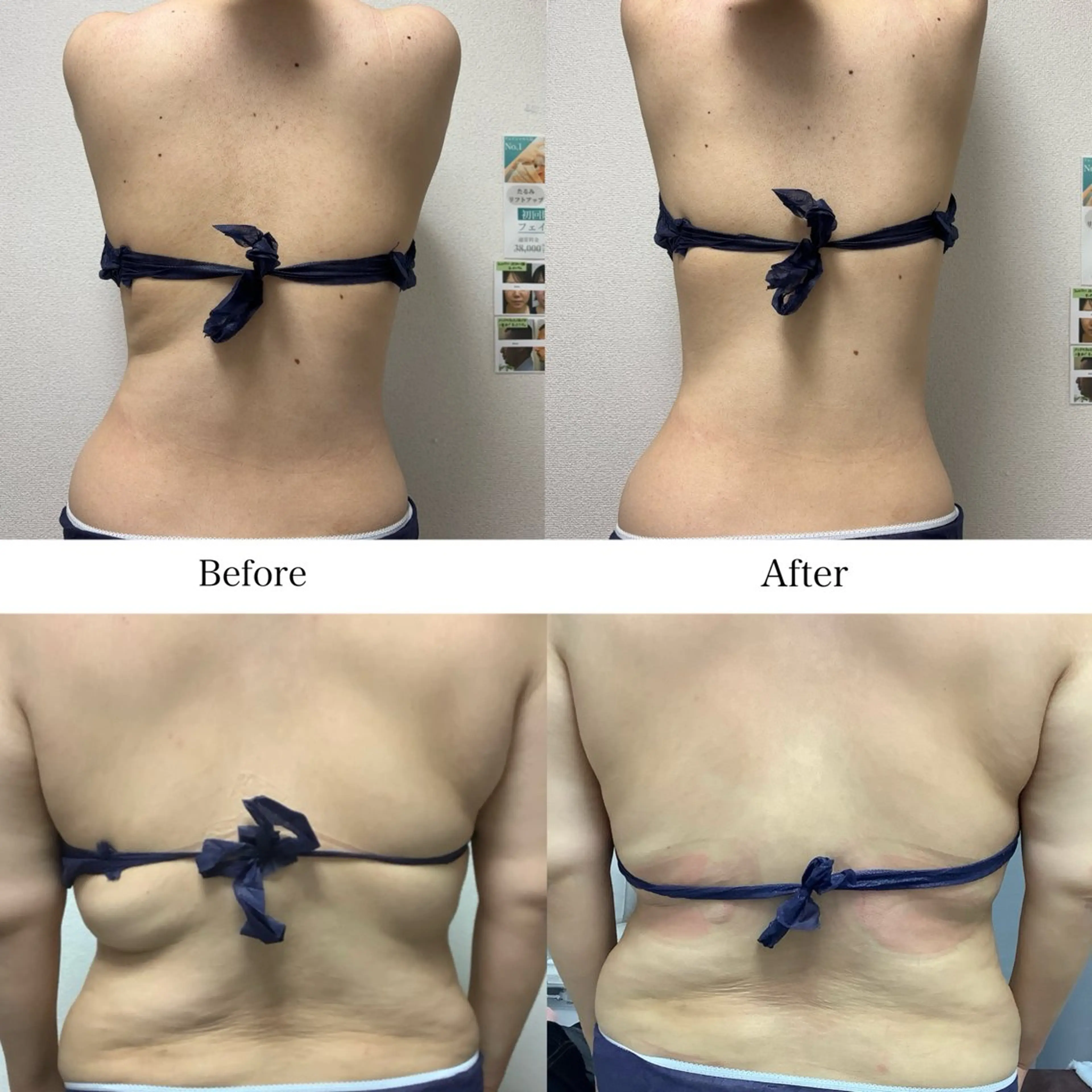 冷却専門店 SLARIのエステ・リラクイメージ