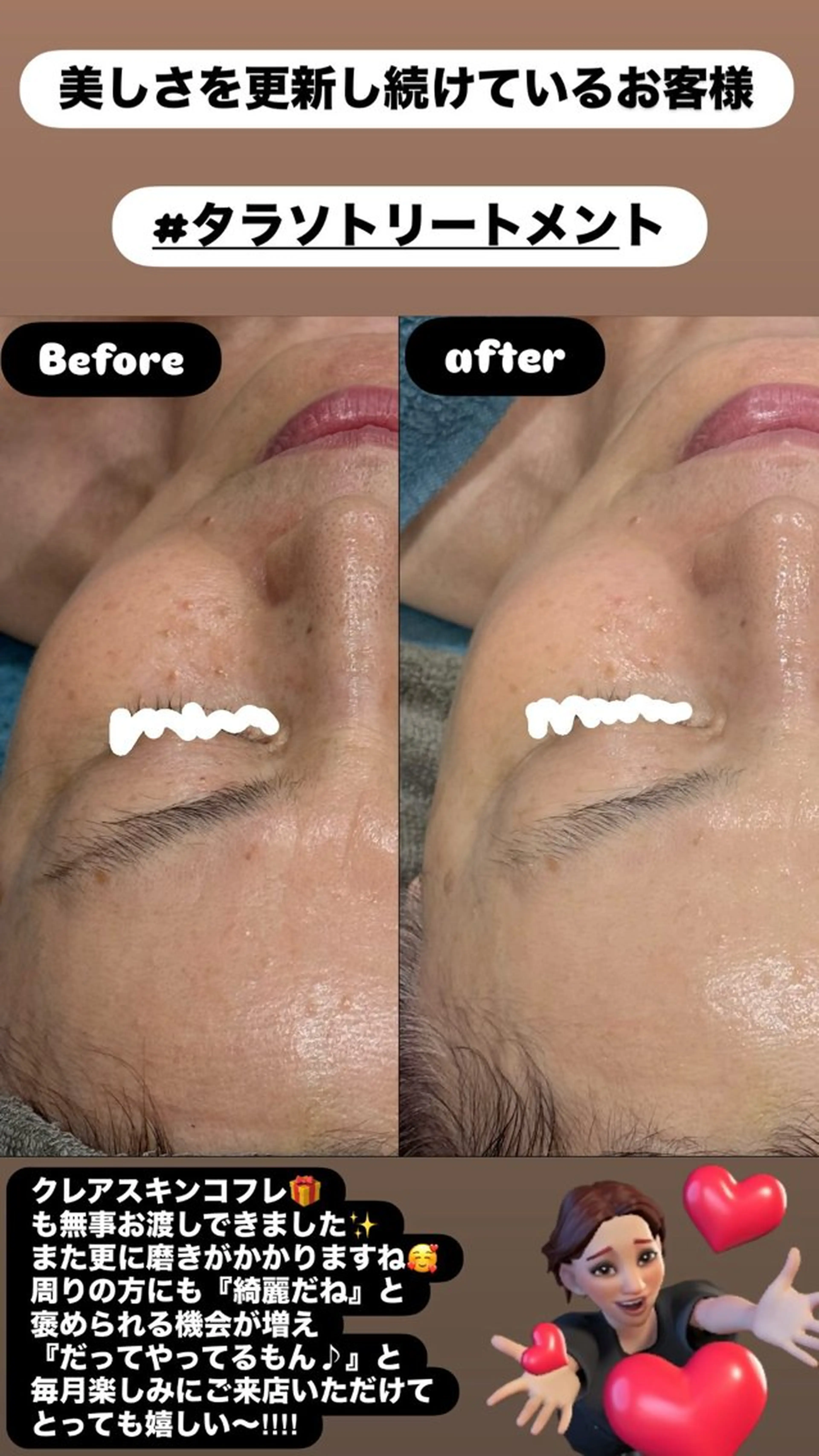 エステ LiZA エステティックサロンのエステ・リラクイメージ