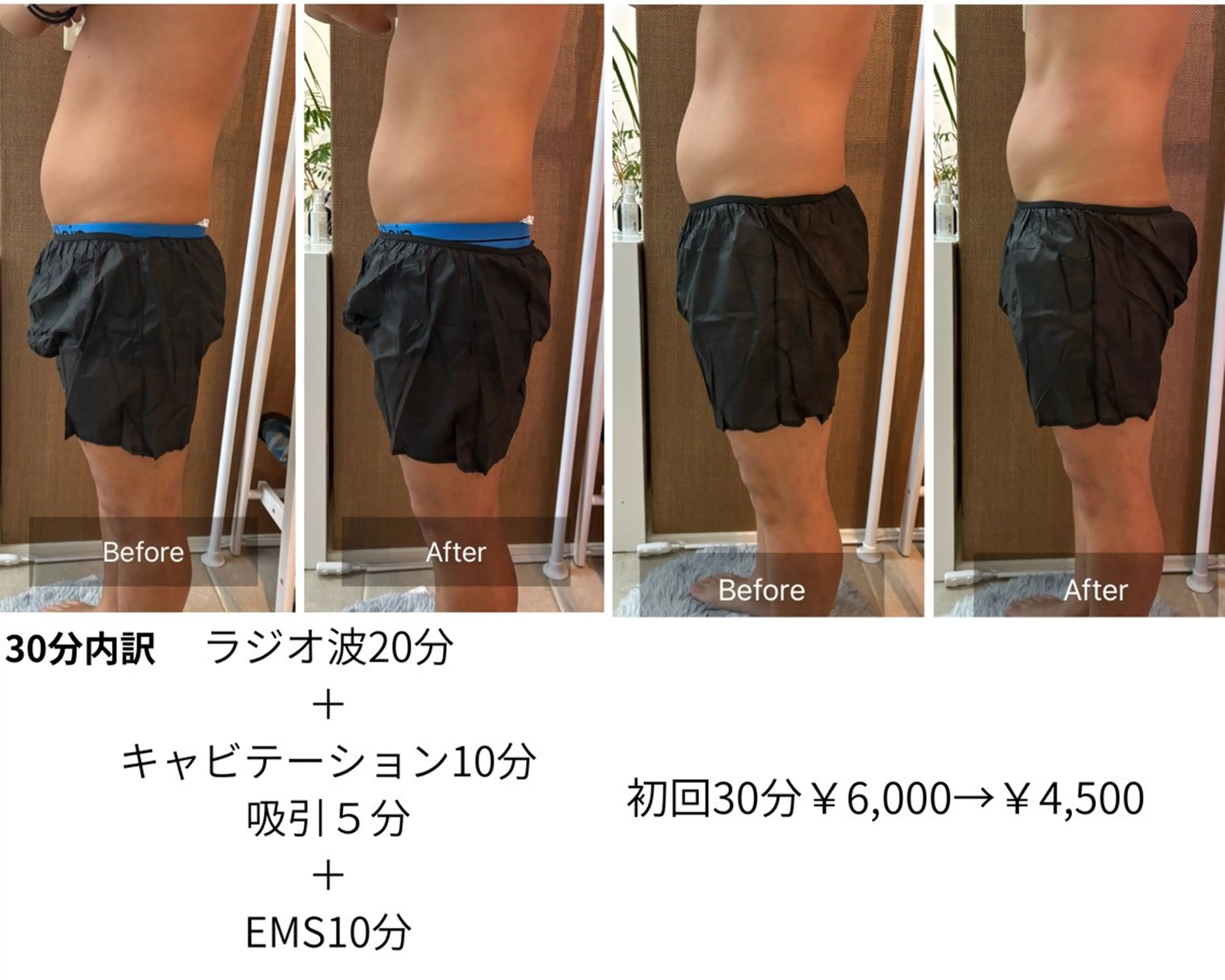 気になるパーツ痩せ30分の写真
