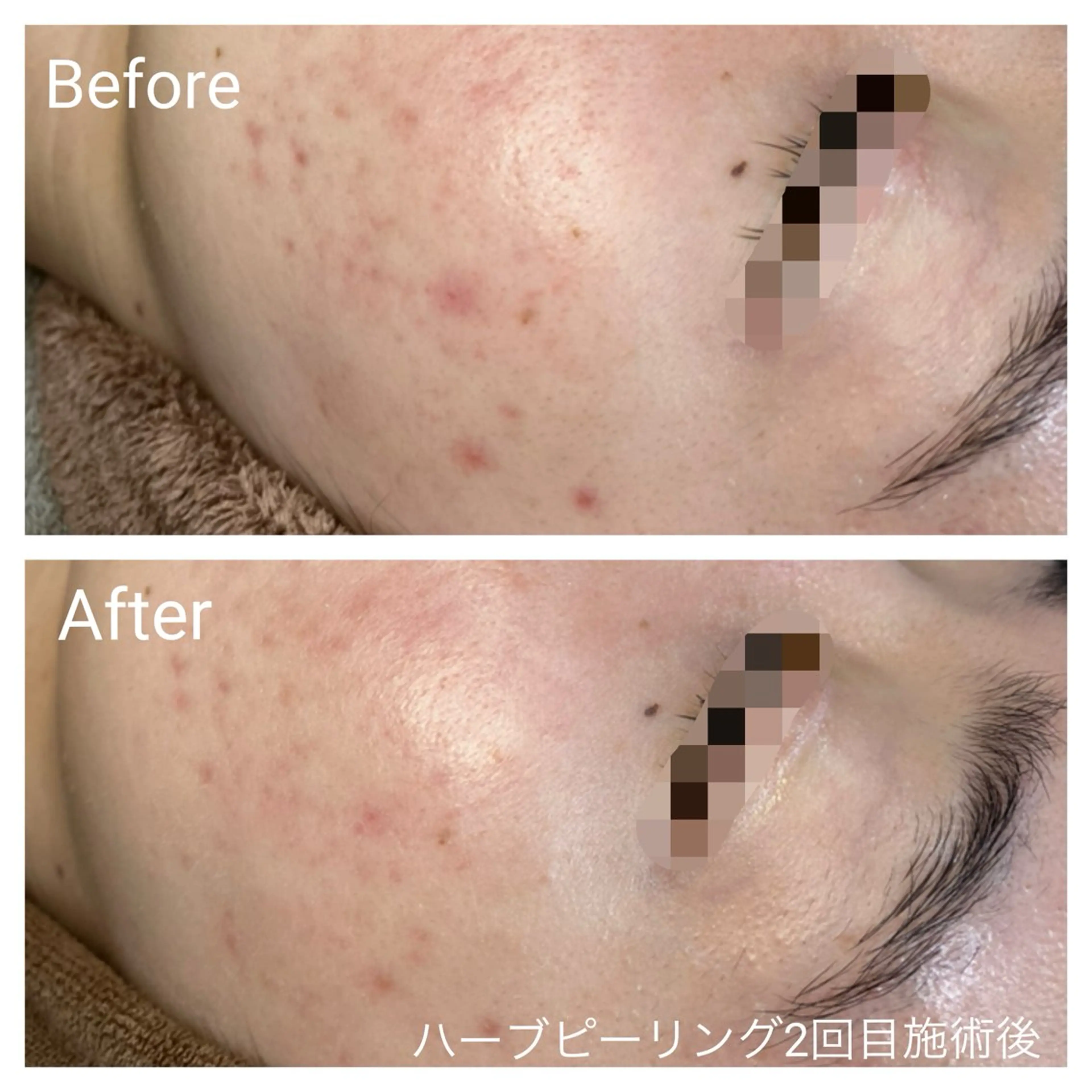 エステ リラク 肌育facial salonのエステ・リラクイメージ