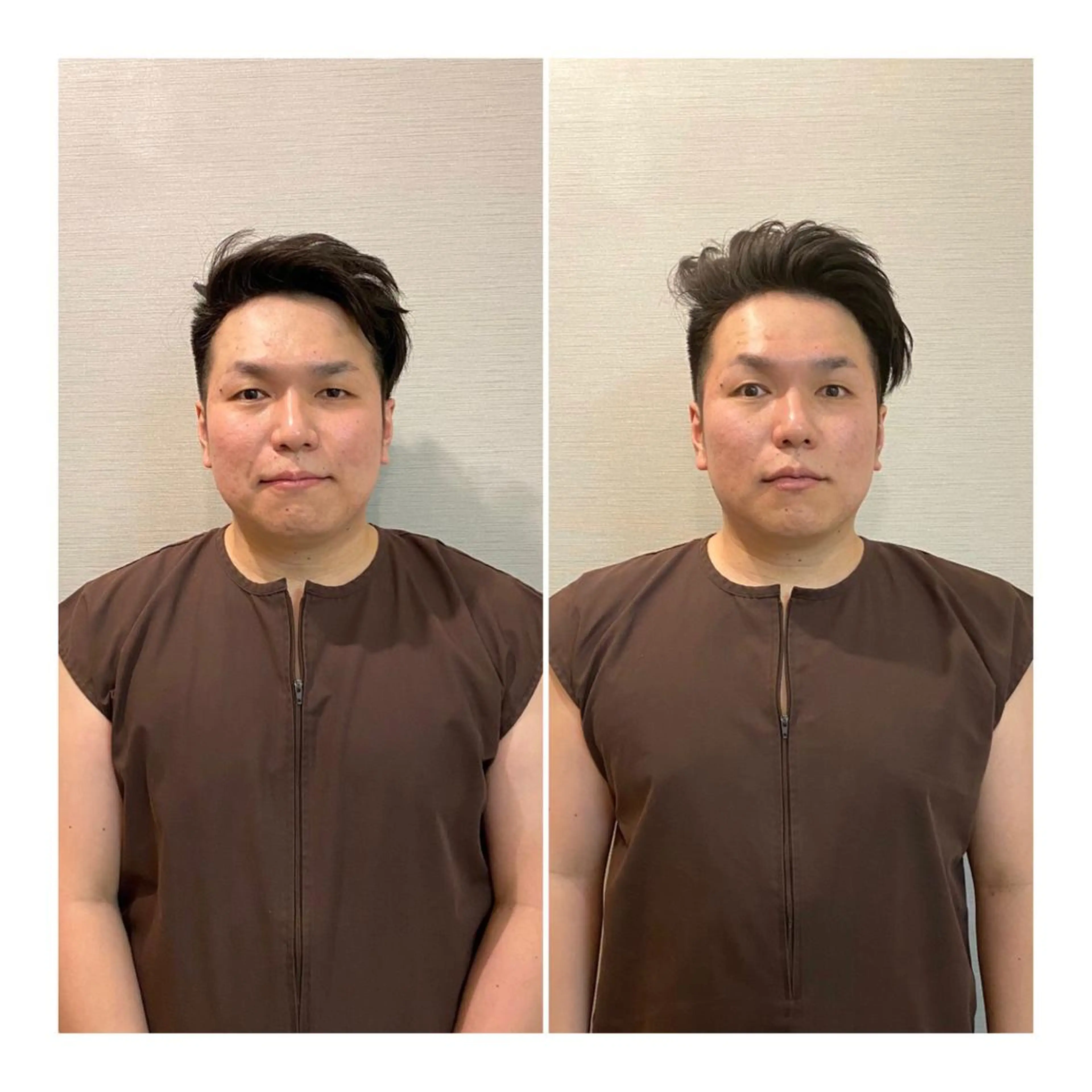 メンズ その他 即小顔♥️美容鍼× ハーブピーリングのその他イメージ