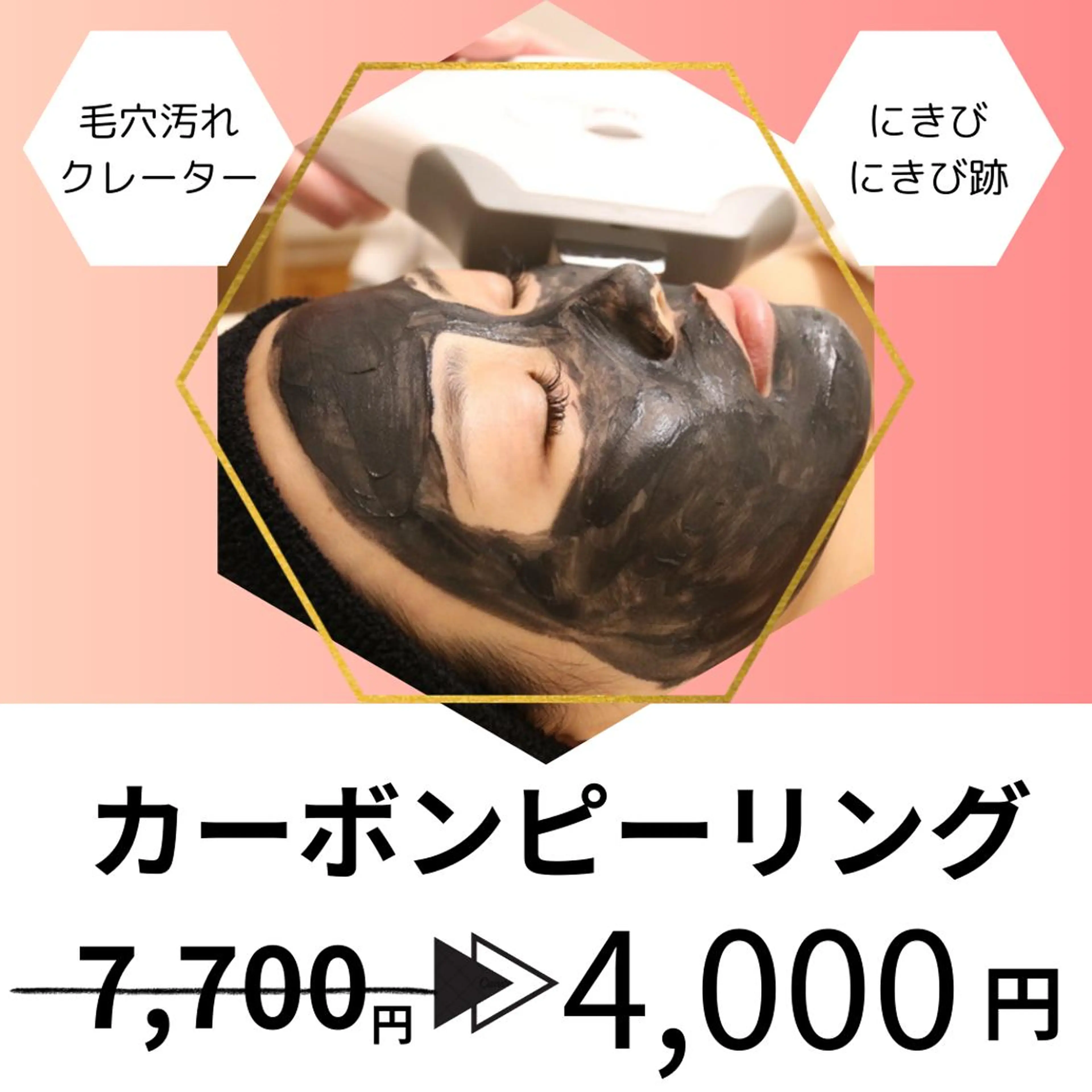 20代から始める脱毛 salonLEPIAのエステ・リラクイメージ
