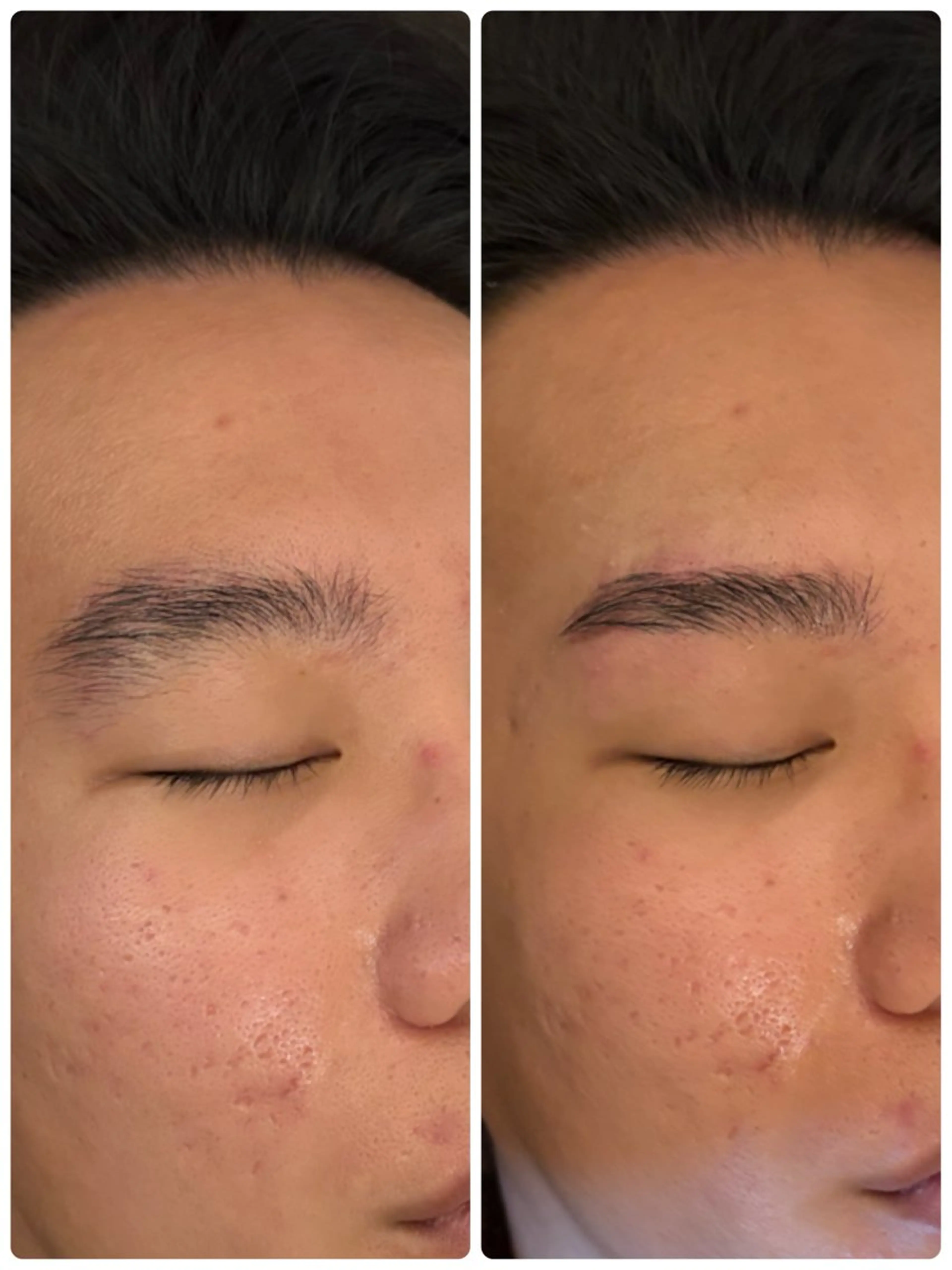 メンズ アイブロウ メンズアイブロウ 眉毛ワックス脱毛 メンズガーデン今池店所属・メンズガーデン 今池の眉毛・アイブロウイメージ