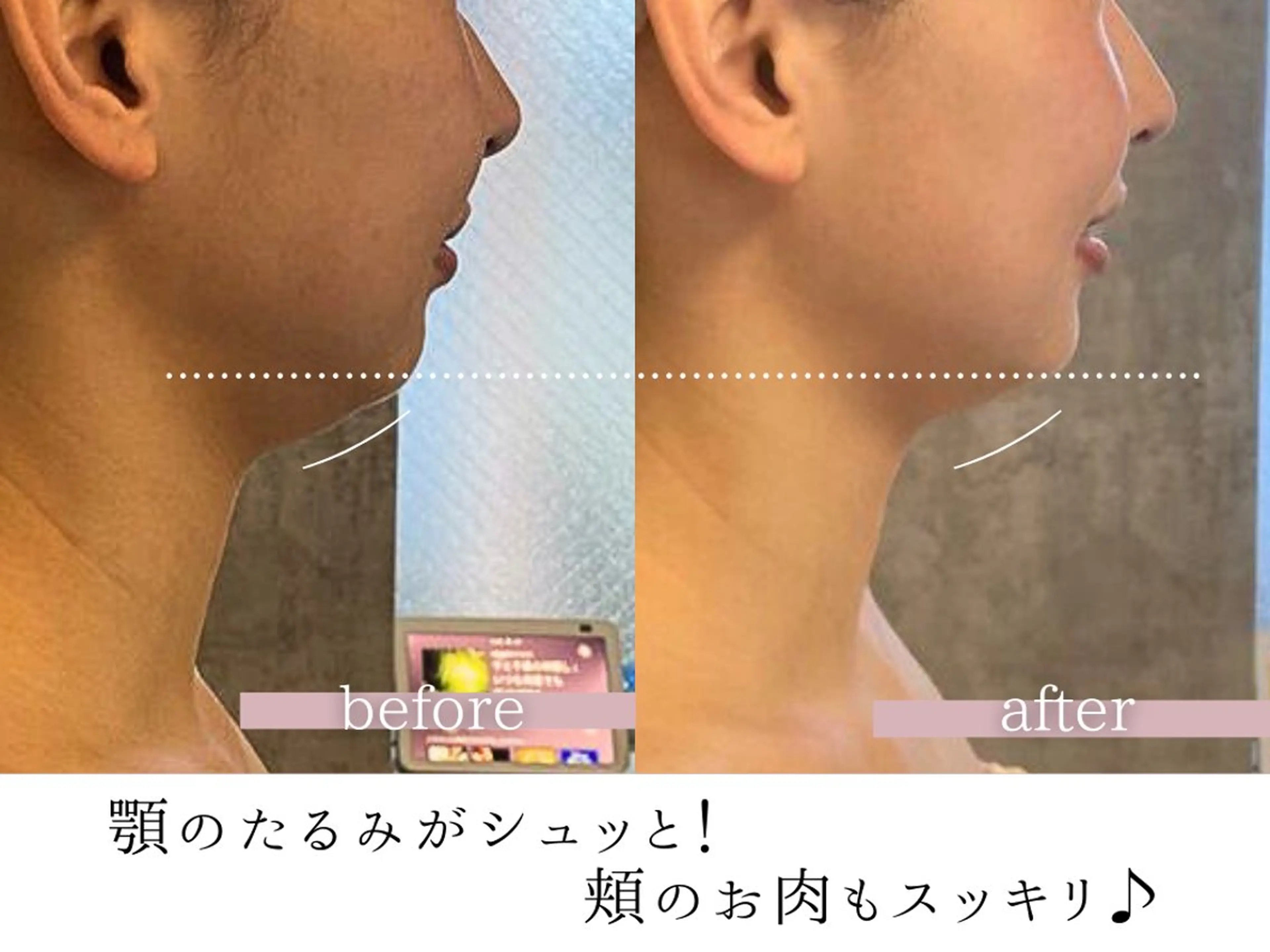 頭蓋骨小顔コルギPerm所属・頭蓋骨小顔コルギ Permのその他イメージ