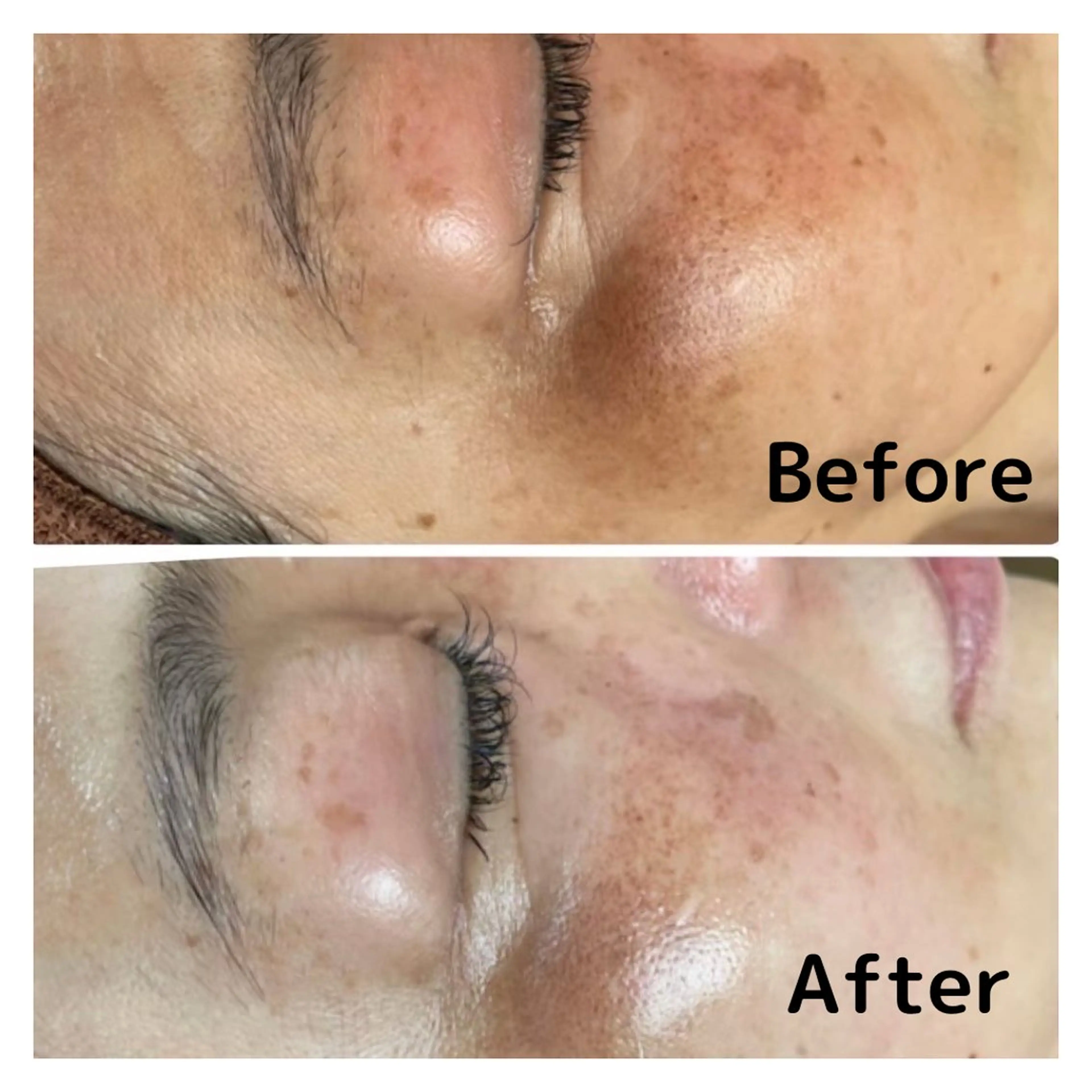 NiU.BEAUTY 新宿のエステ・リラクイメージ