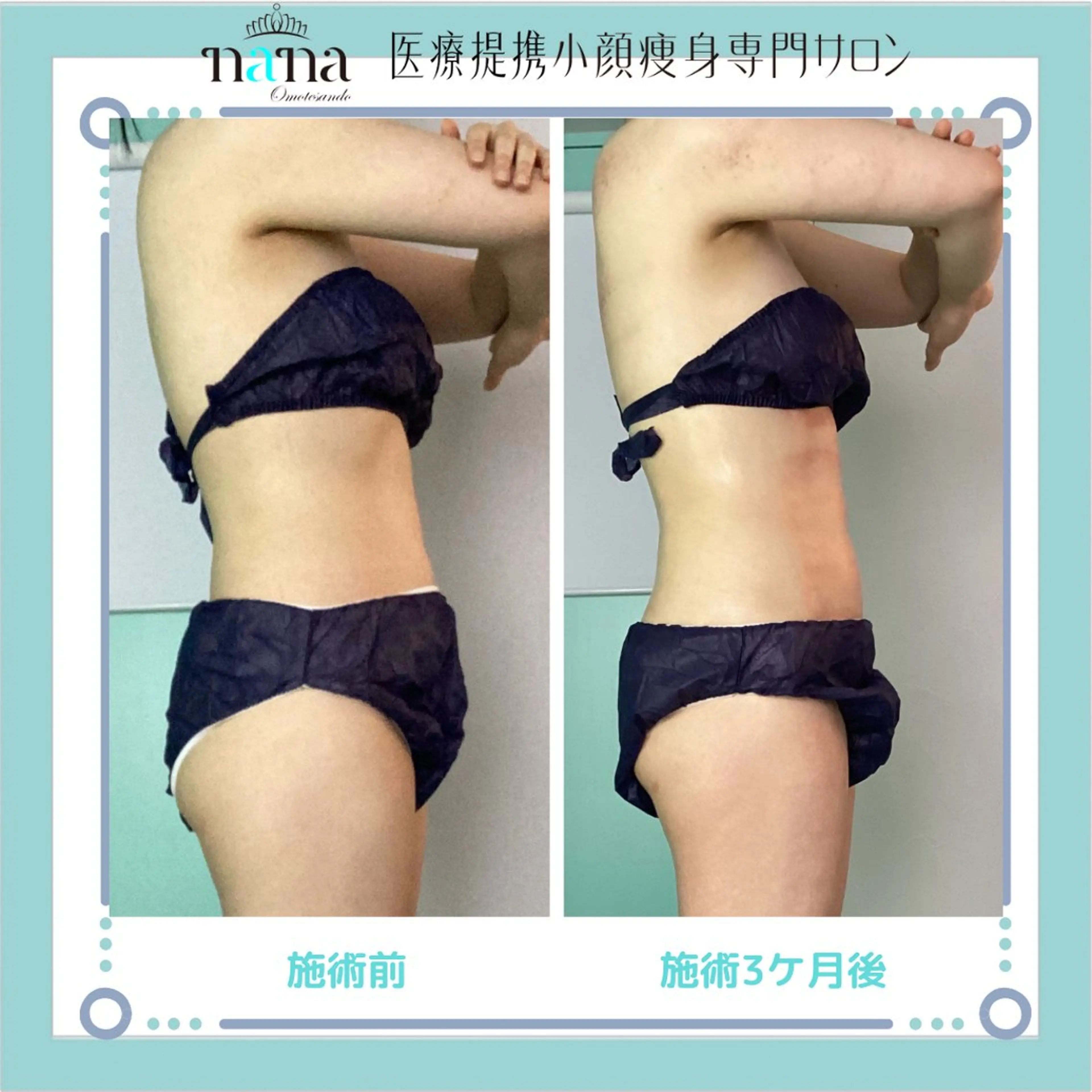 小顔痩身インディバ Nana表参道のエステ・リラクイメージ