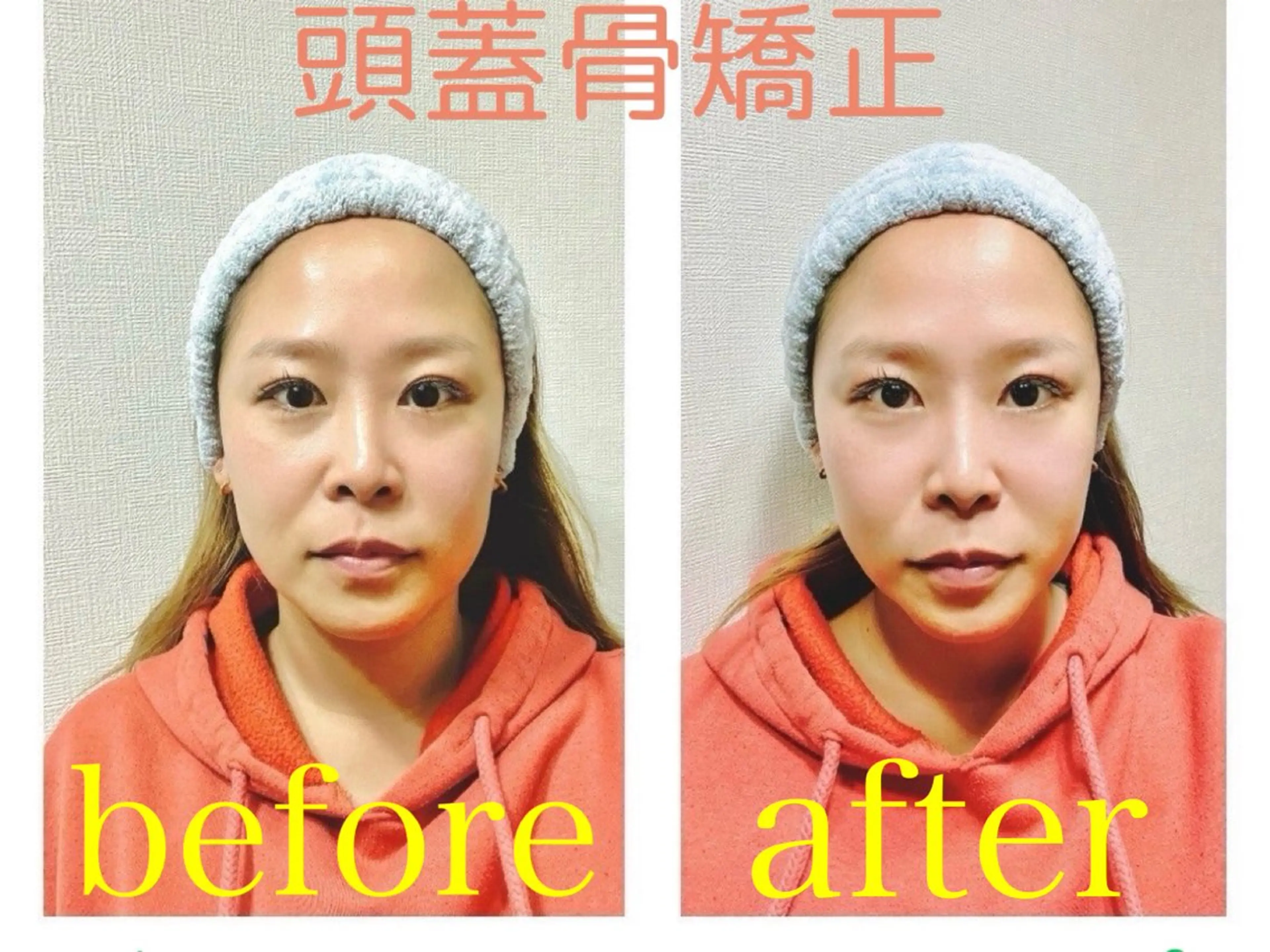 脱毛サロン　ニカ所属・☀️脱毛・美容矯正 サロン　ニカ☀️のエステ・リラクイメージ