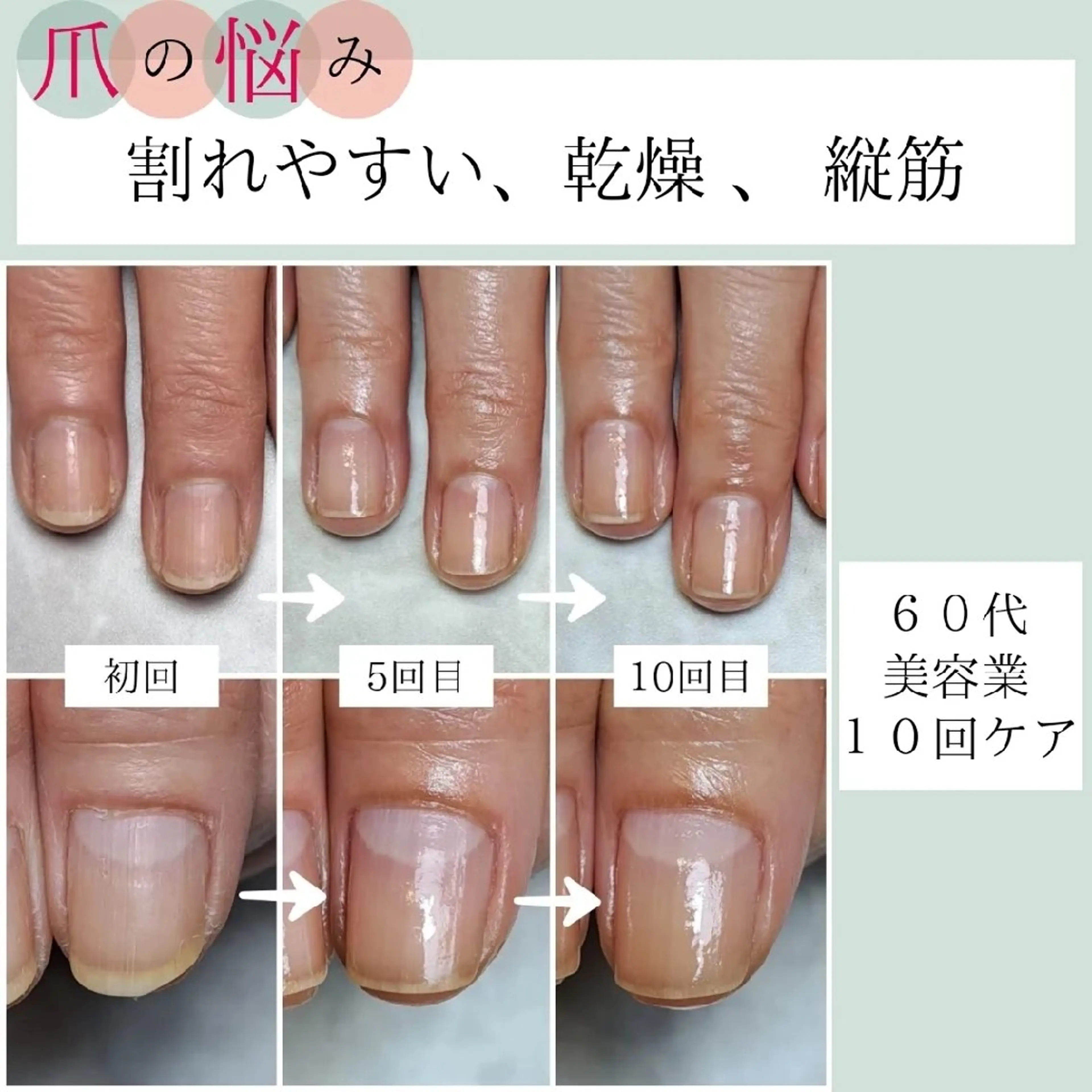 ネイル ハンドケア AKT NAIL所属・AKT Beauty ドライヘッドスパのネイルデザイン