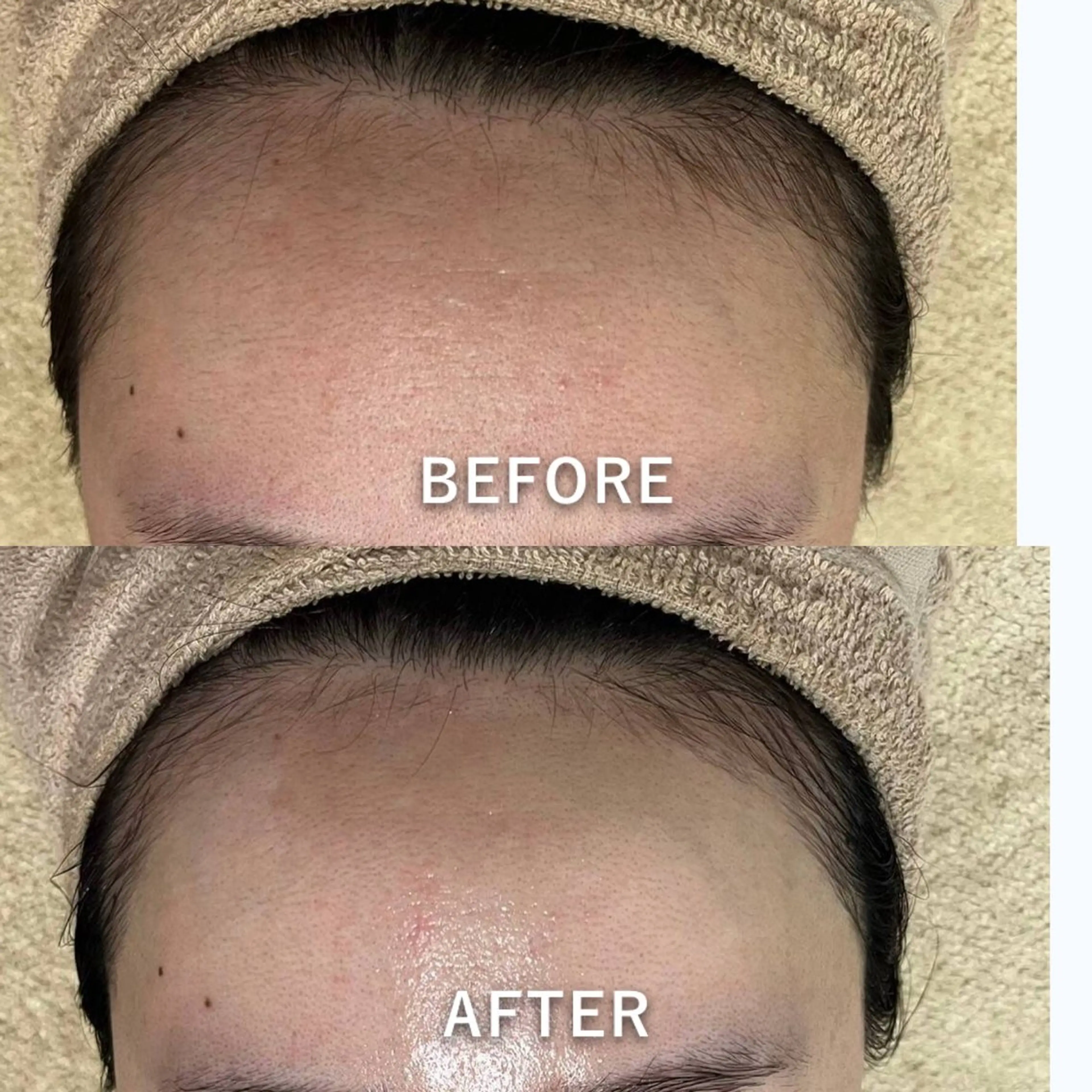 脱毛 【美肌専門 脱毛】 サロンドジェシカのエステ・リラクイメージ