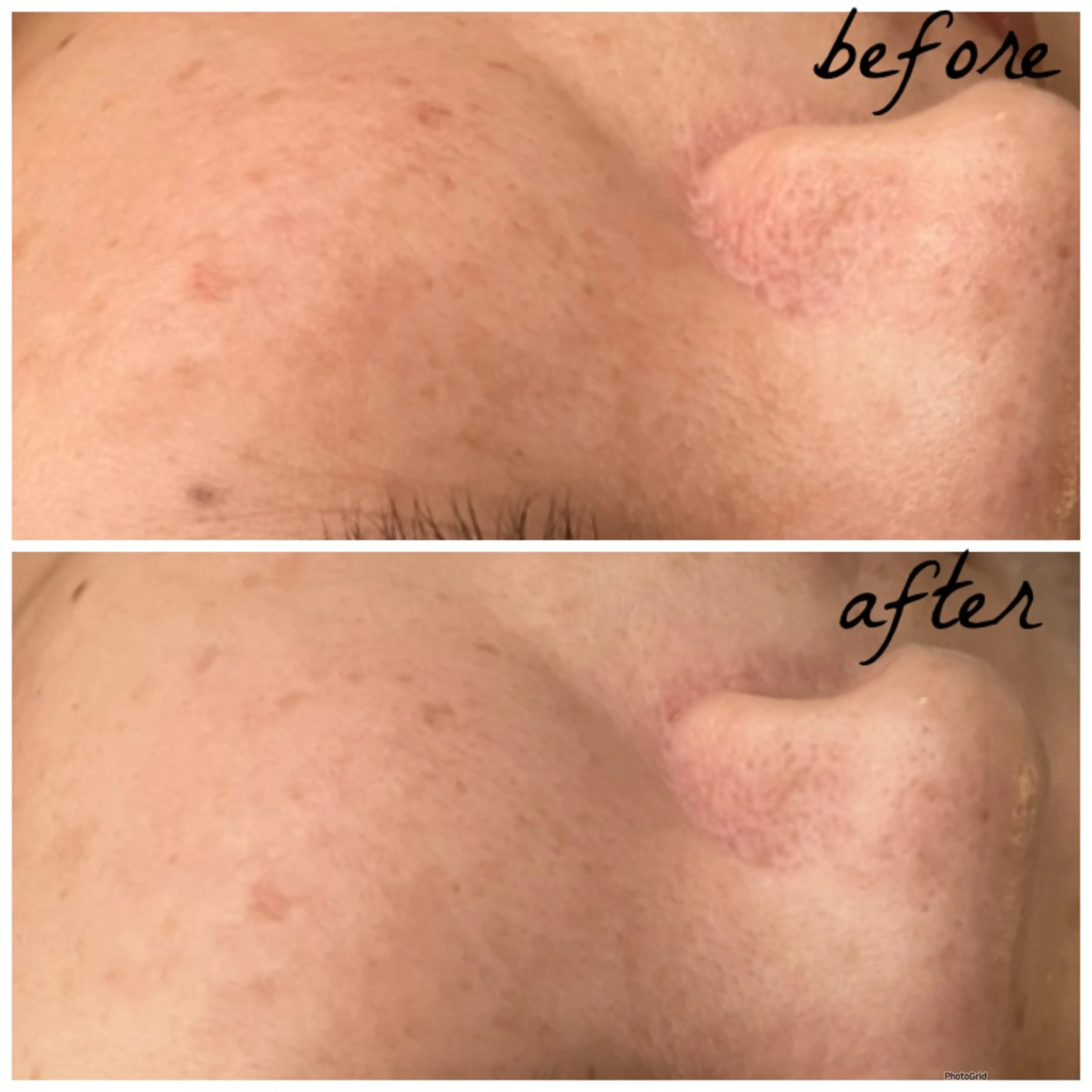 メンズ エステ メナード岐阜茜部 杉浦のエステ・リラクイメージ