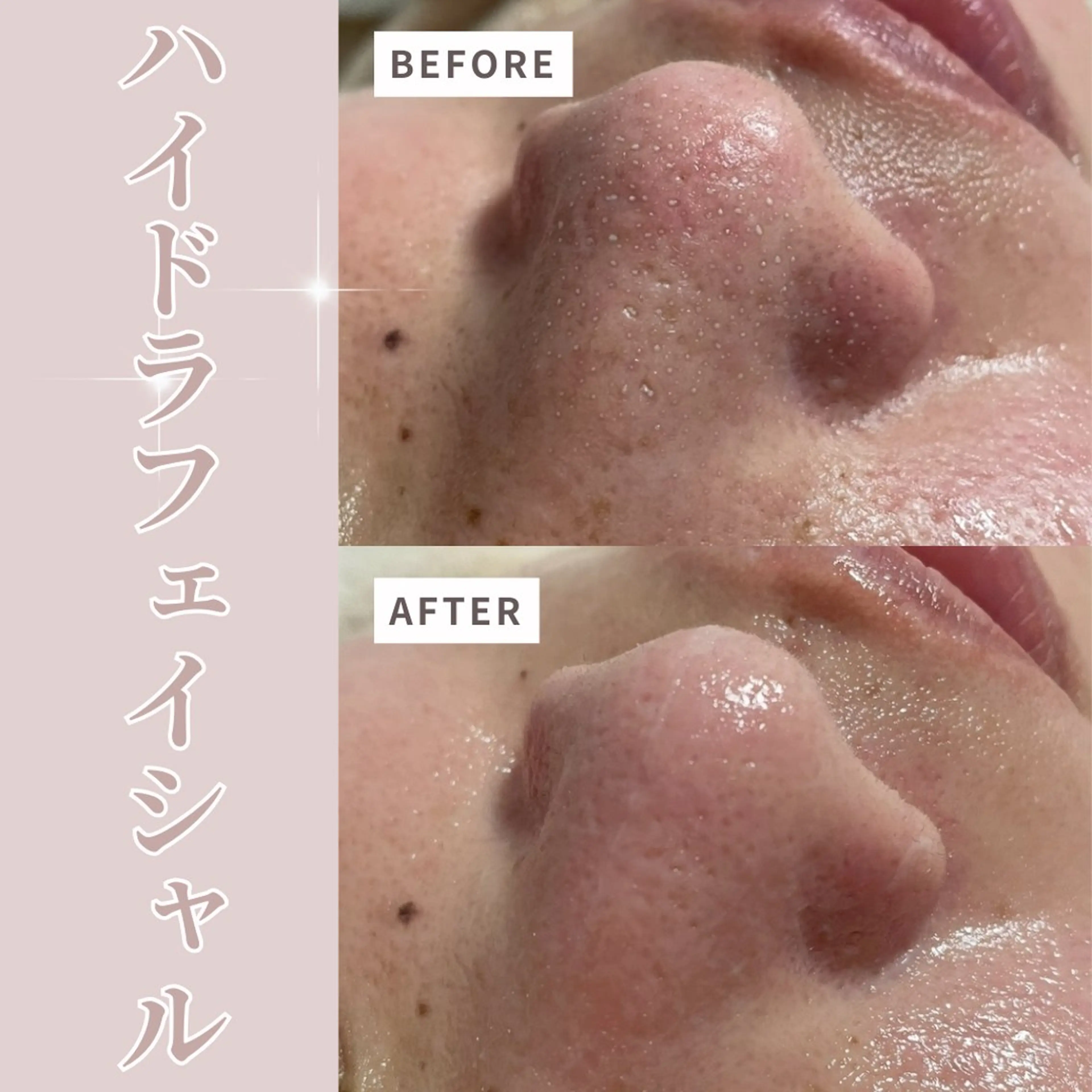 エステ リラク プライベートサロン Belle（ベル）のエステ・リラクイメージ